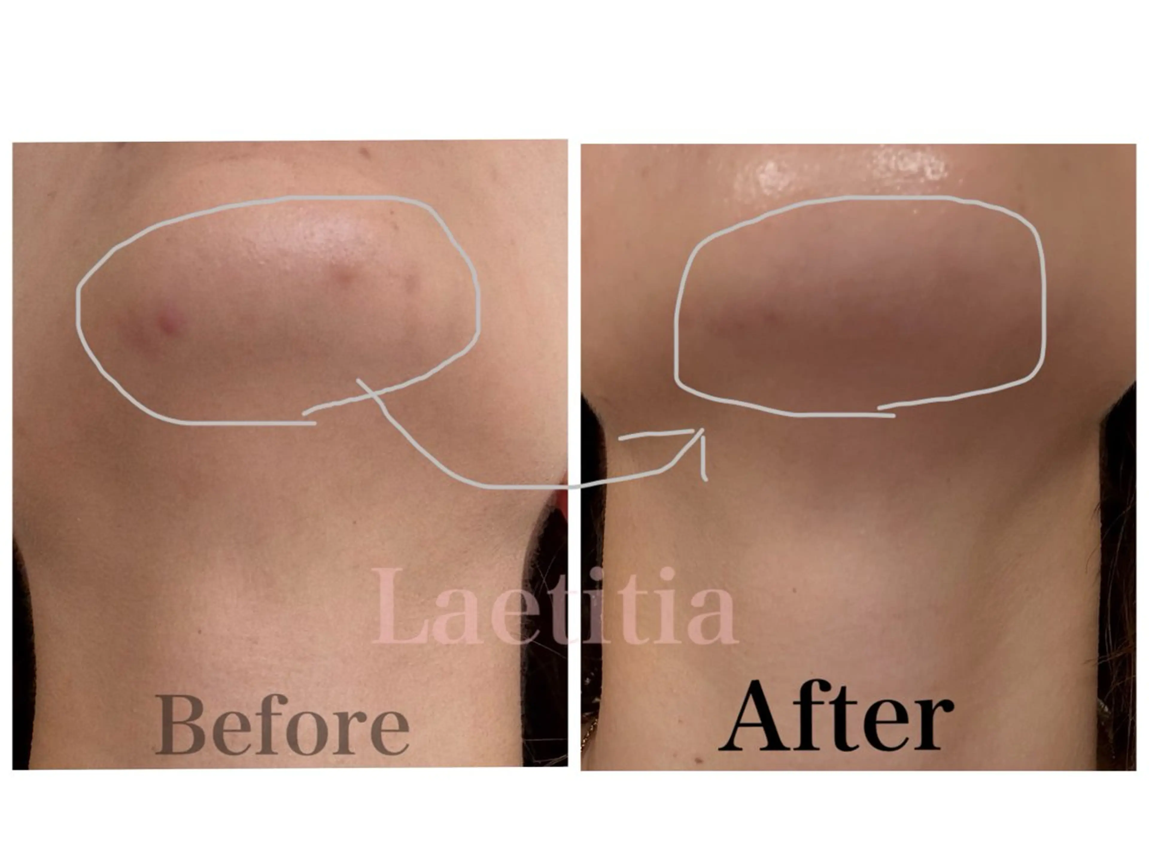 エステ レティティア秋葉原店 Yoshizawaのエステ・リラクイメージ