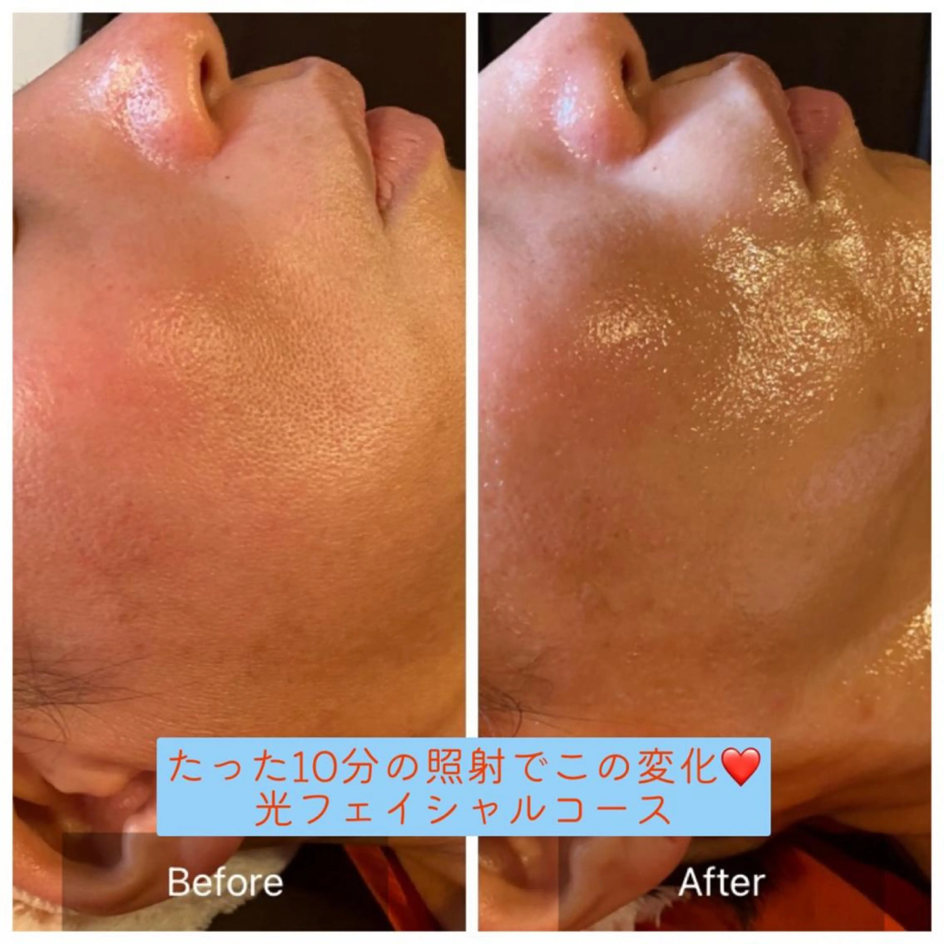 毛穴から始める肌メン テマンダリンオレンジのエステ・リラクイメージ