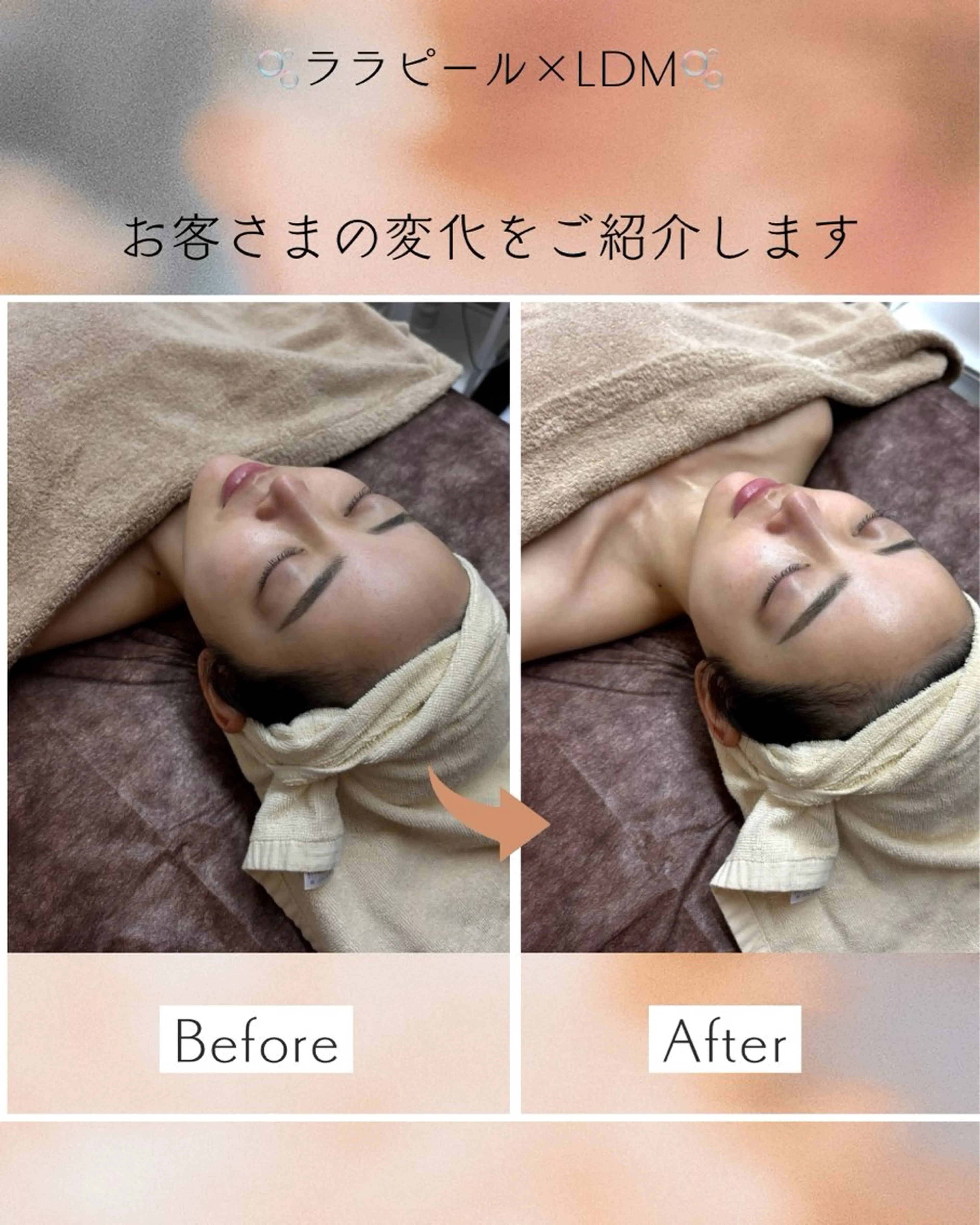 コアラル恵比寿店 chiakiのエステ・リラクイメージ