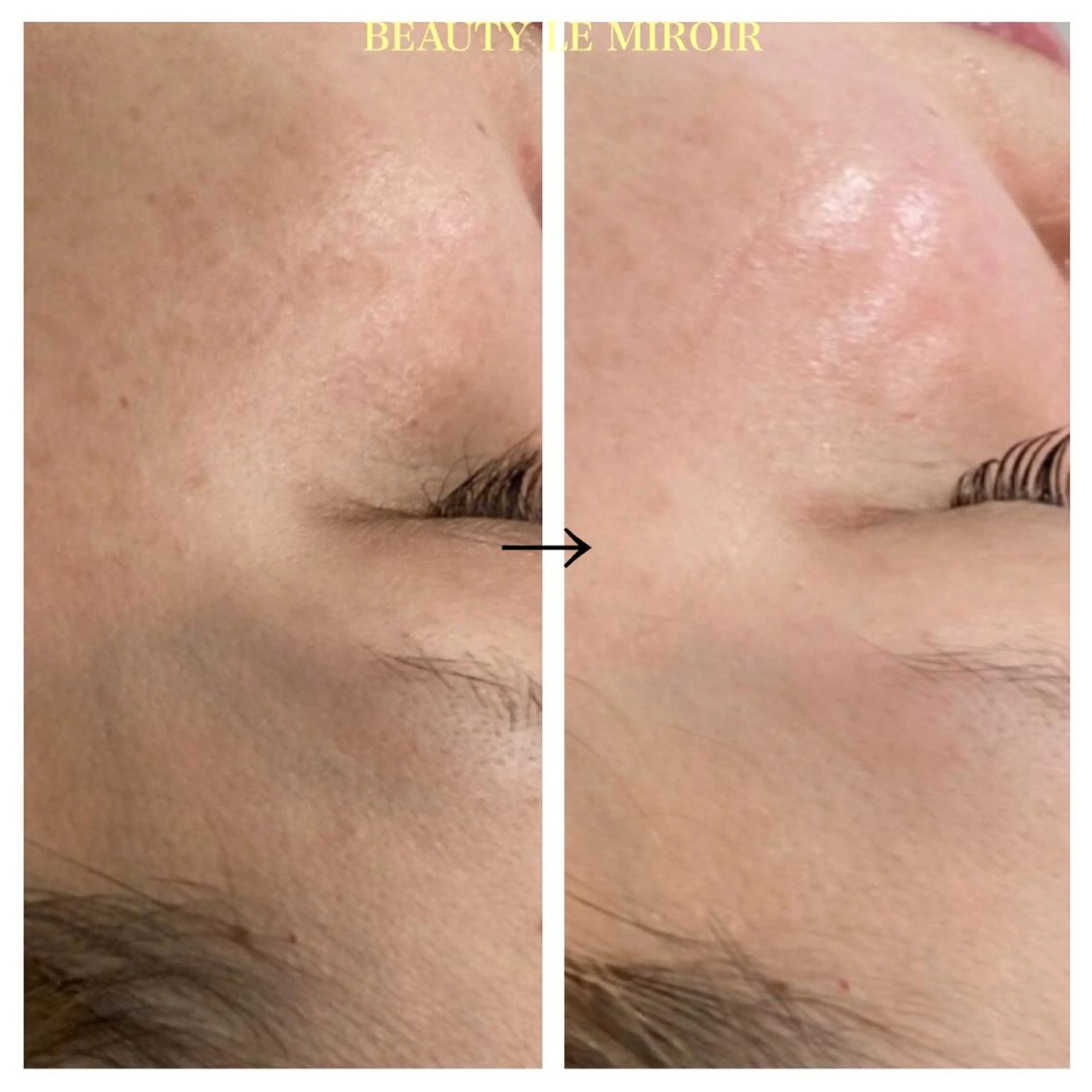 ビューティー ミロワールのエステ・リラクイメージ