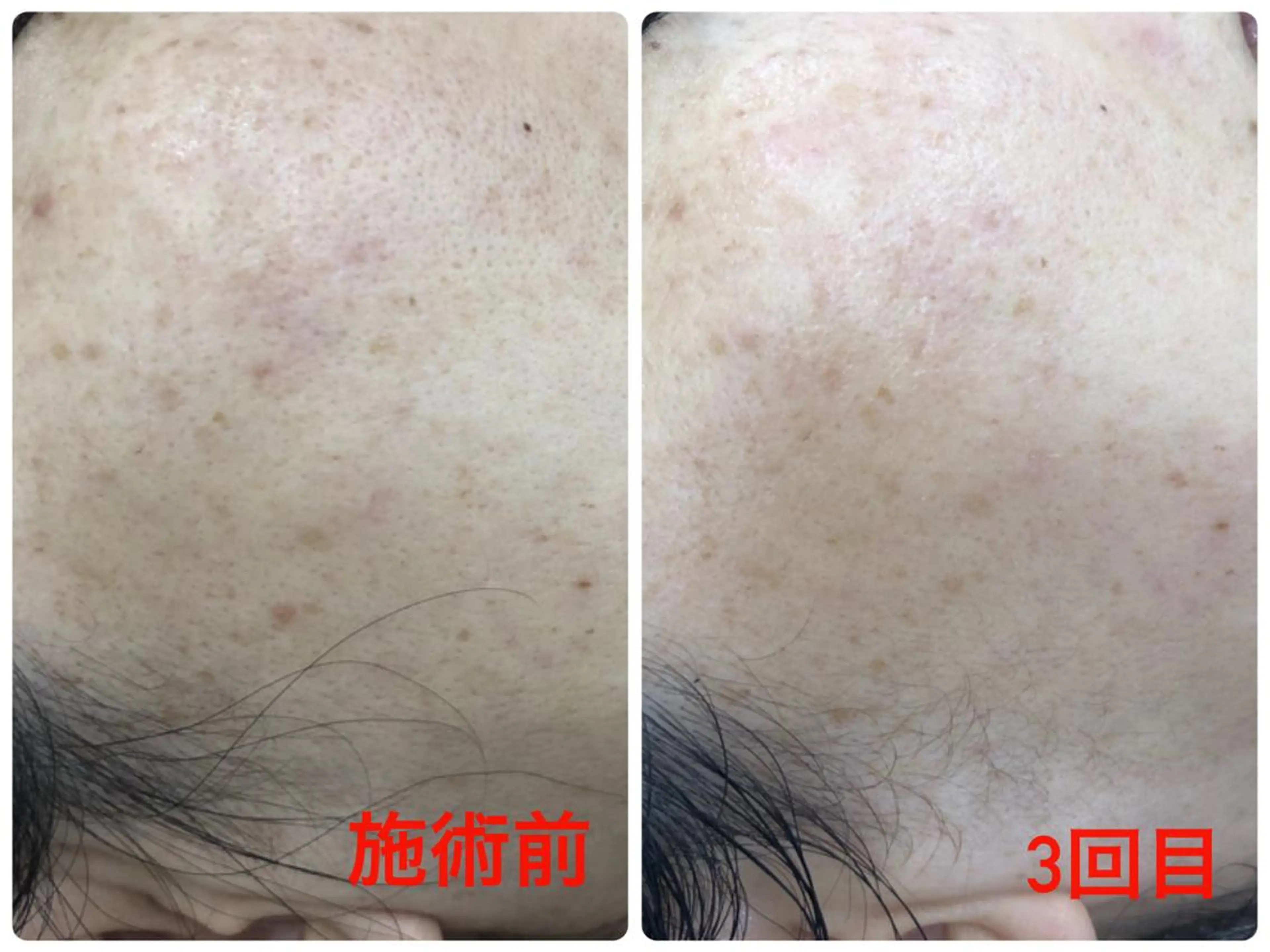 その他 宮野 麻綺のエステ・リラクイメージ