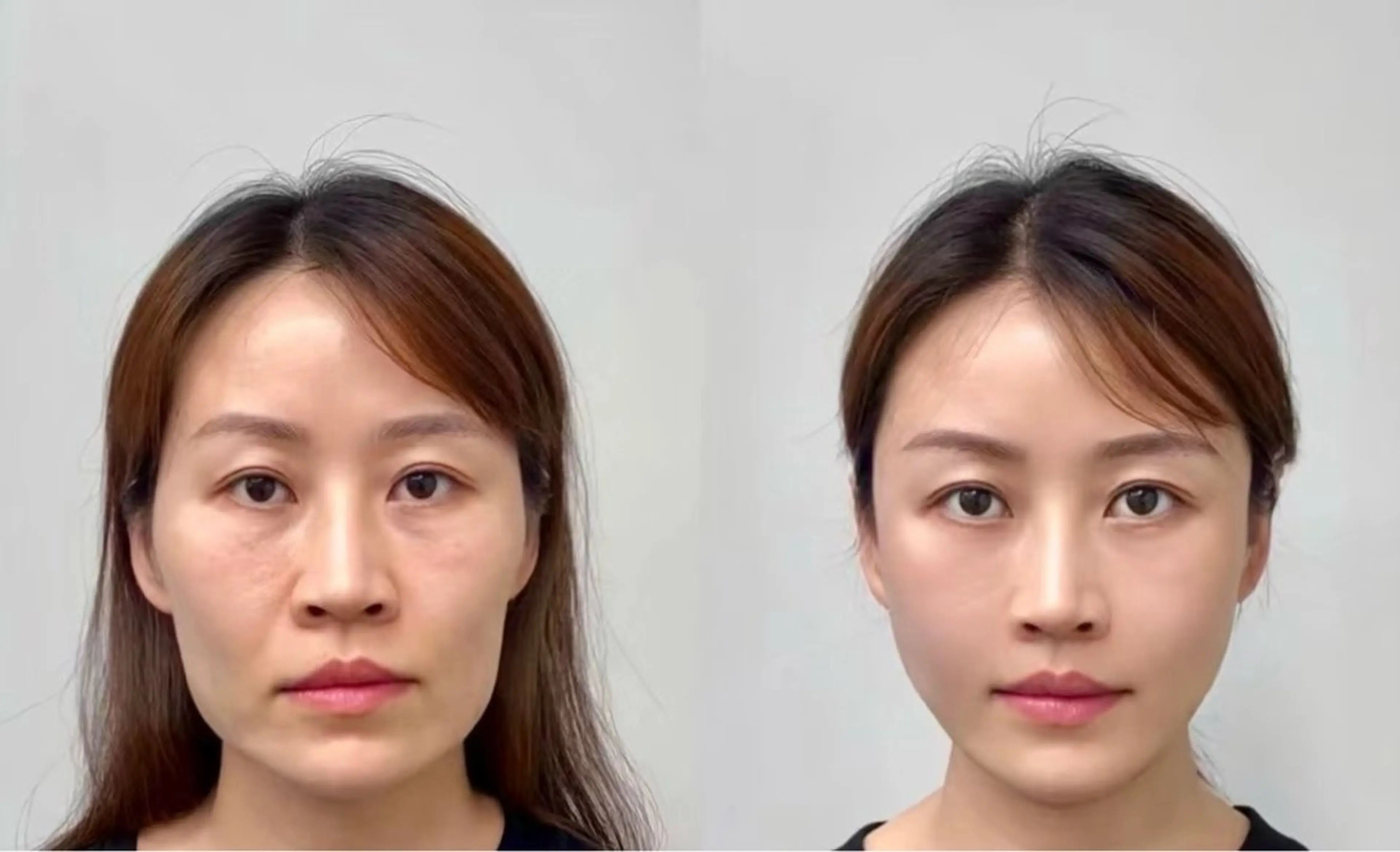 ネイル エステ aliaハーブ水光店 エステティシャン募集のエステ・リラクイメージ