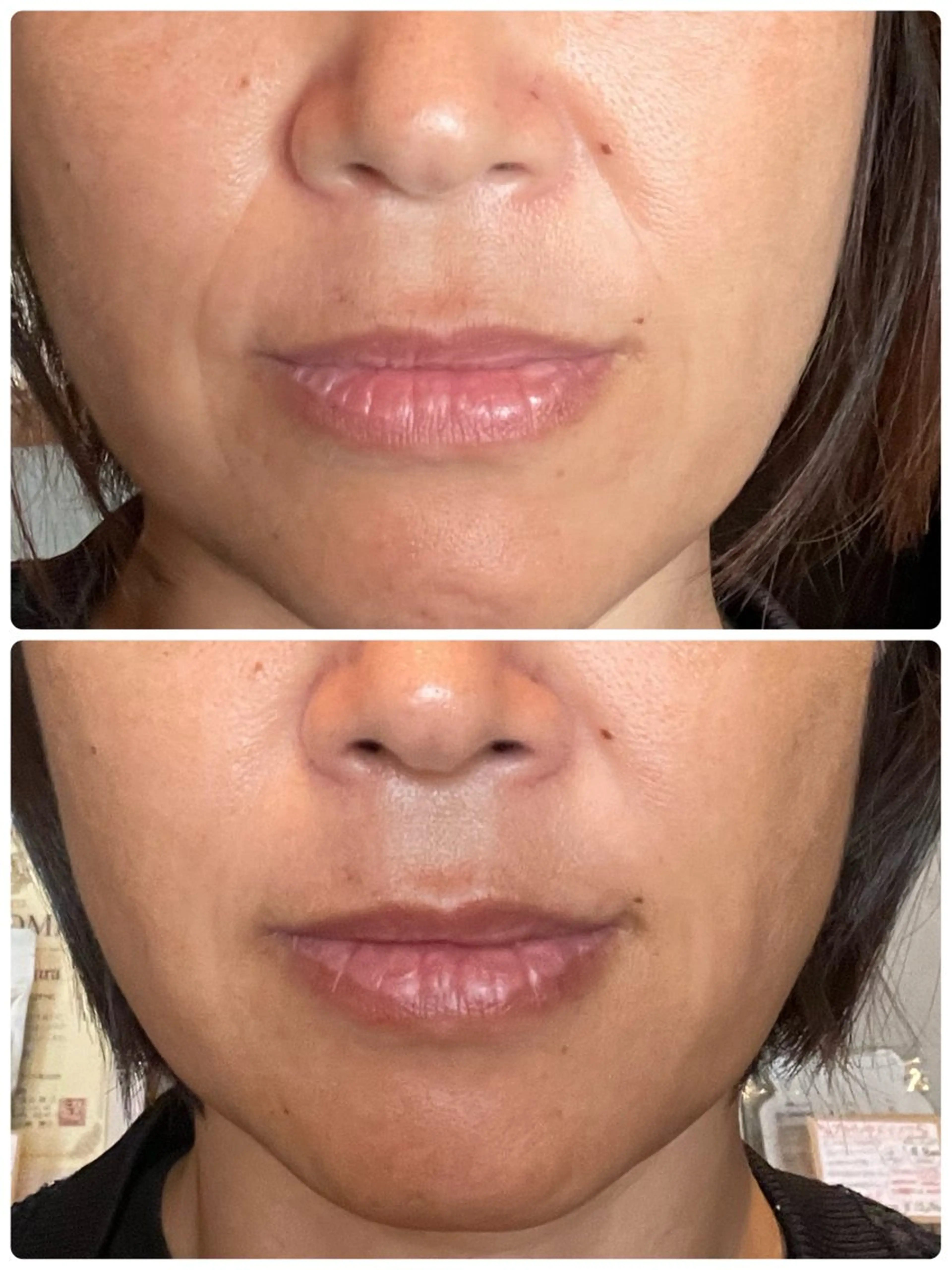 ✨当店No.2✨バイオセルショット65の写真