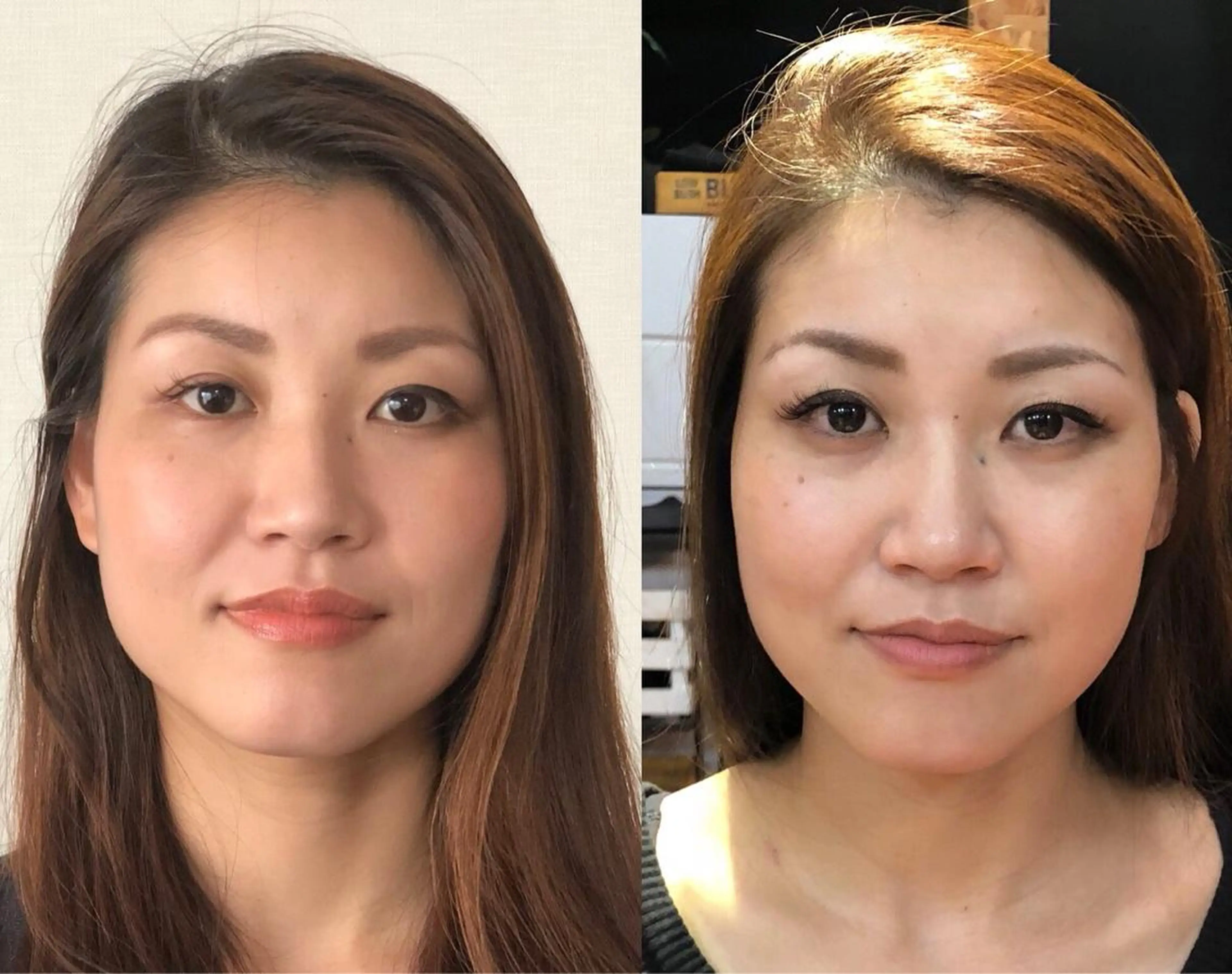 次世代のエイジングケア☆幹細胞フェイシャル 45分の写真