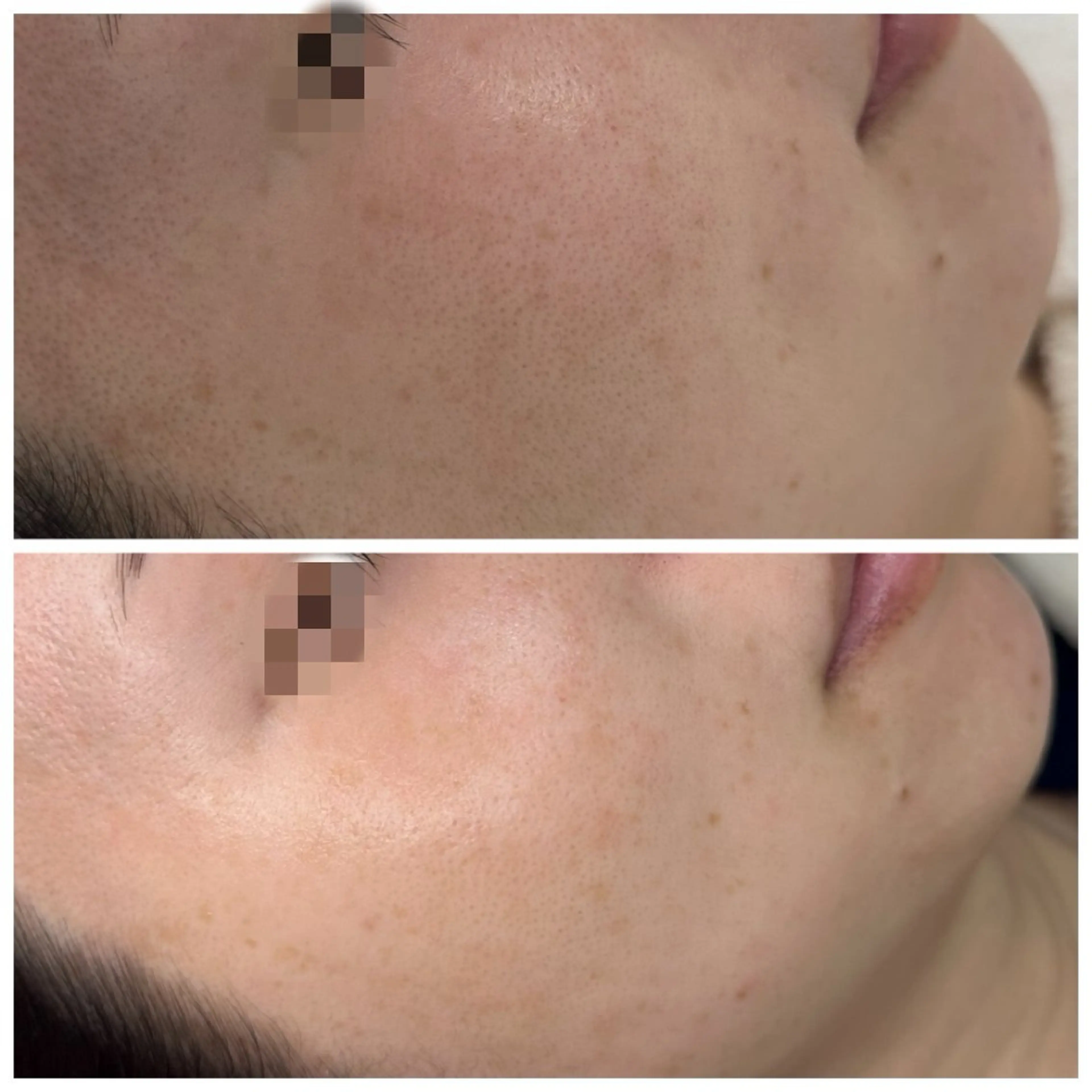 トータルしみケア専門 NICA(ニカ)の眉毛・アイブロウイメージ