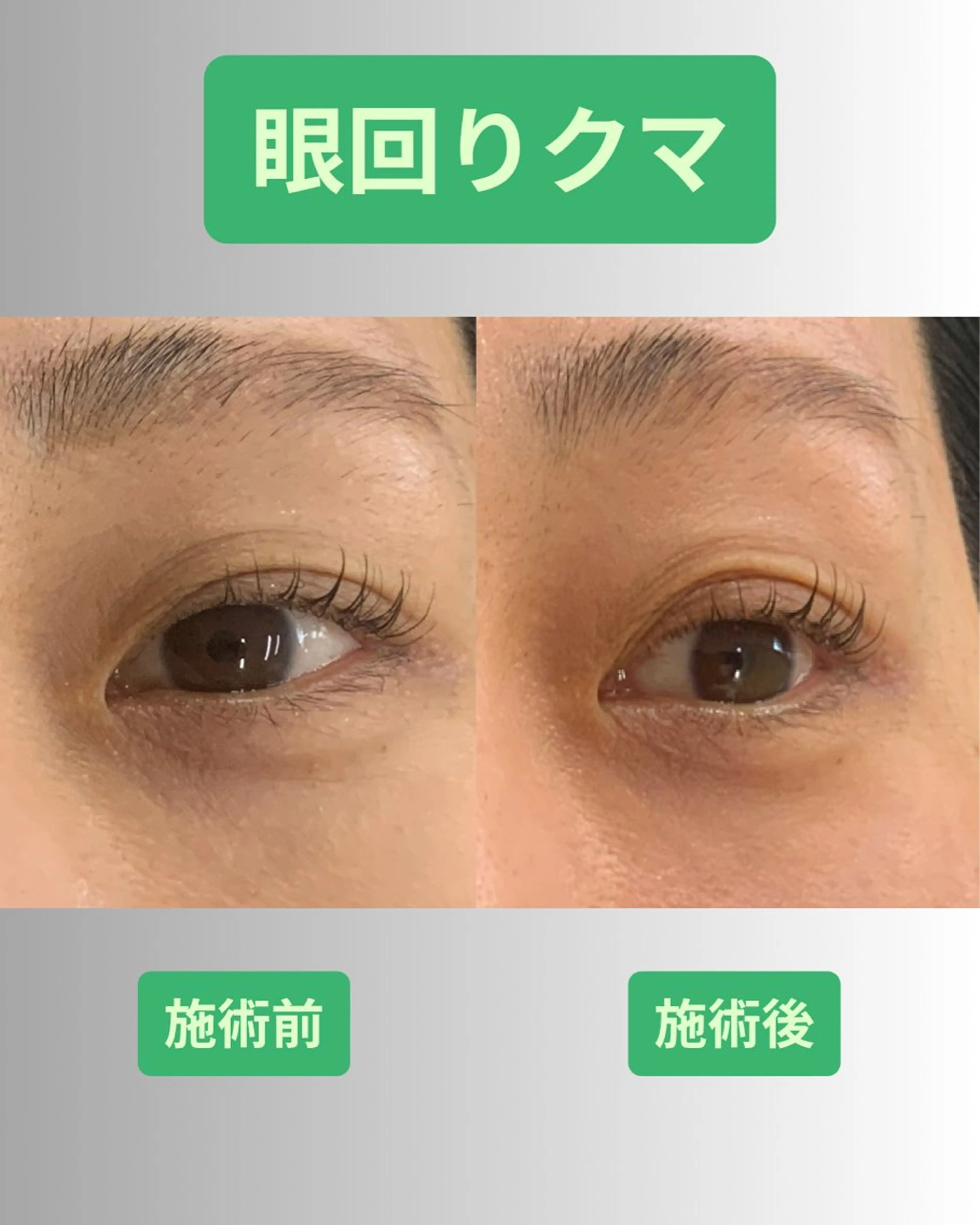 エステ リラク 河輪 鍼灸接骨院のエステ・リラクイメージ