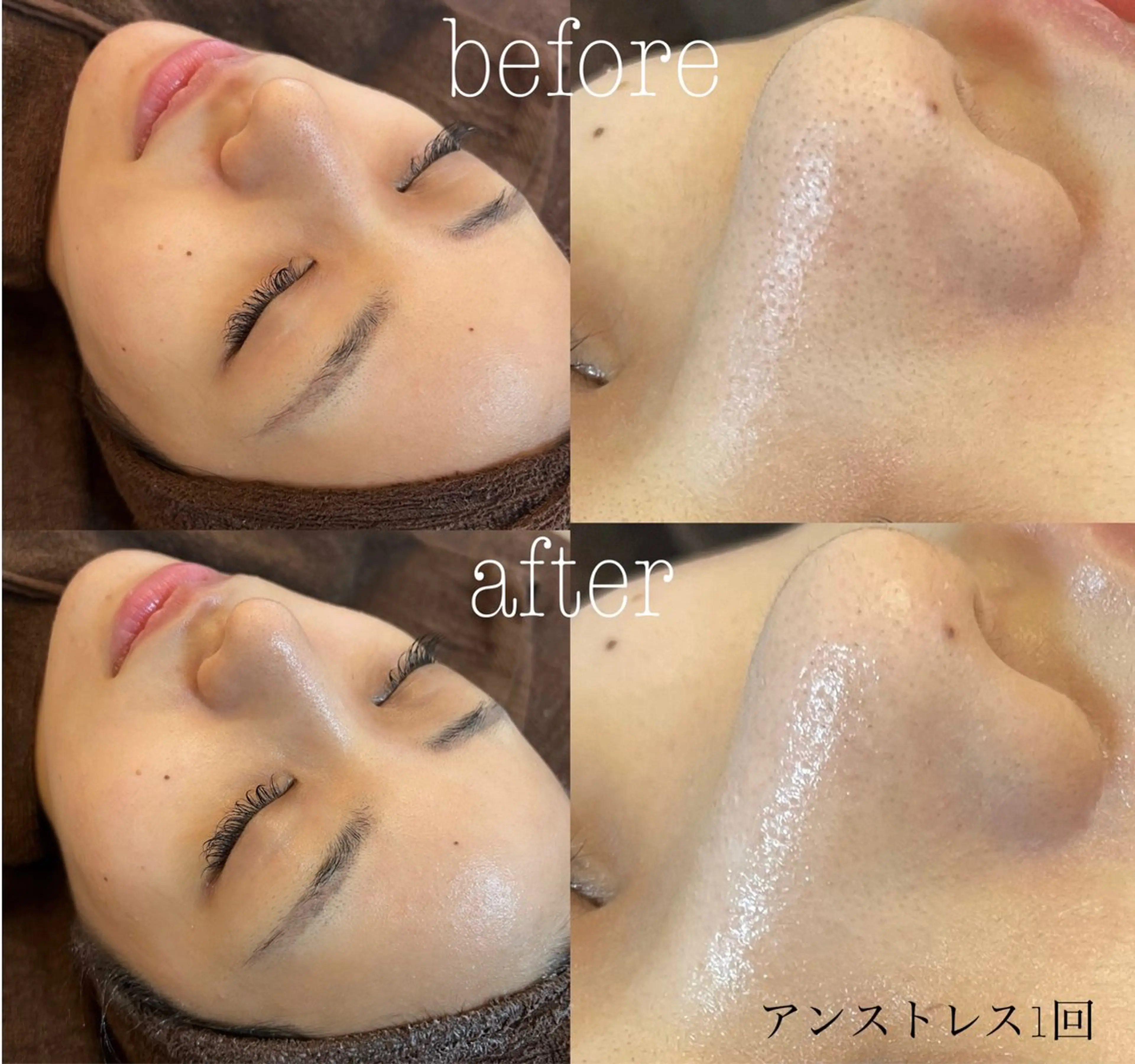 エステ 肌質改善|美眉サロン Cannone’のエステ・リラクイメージ