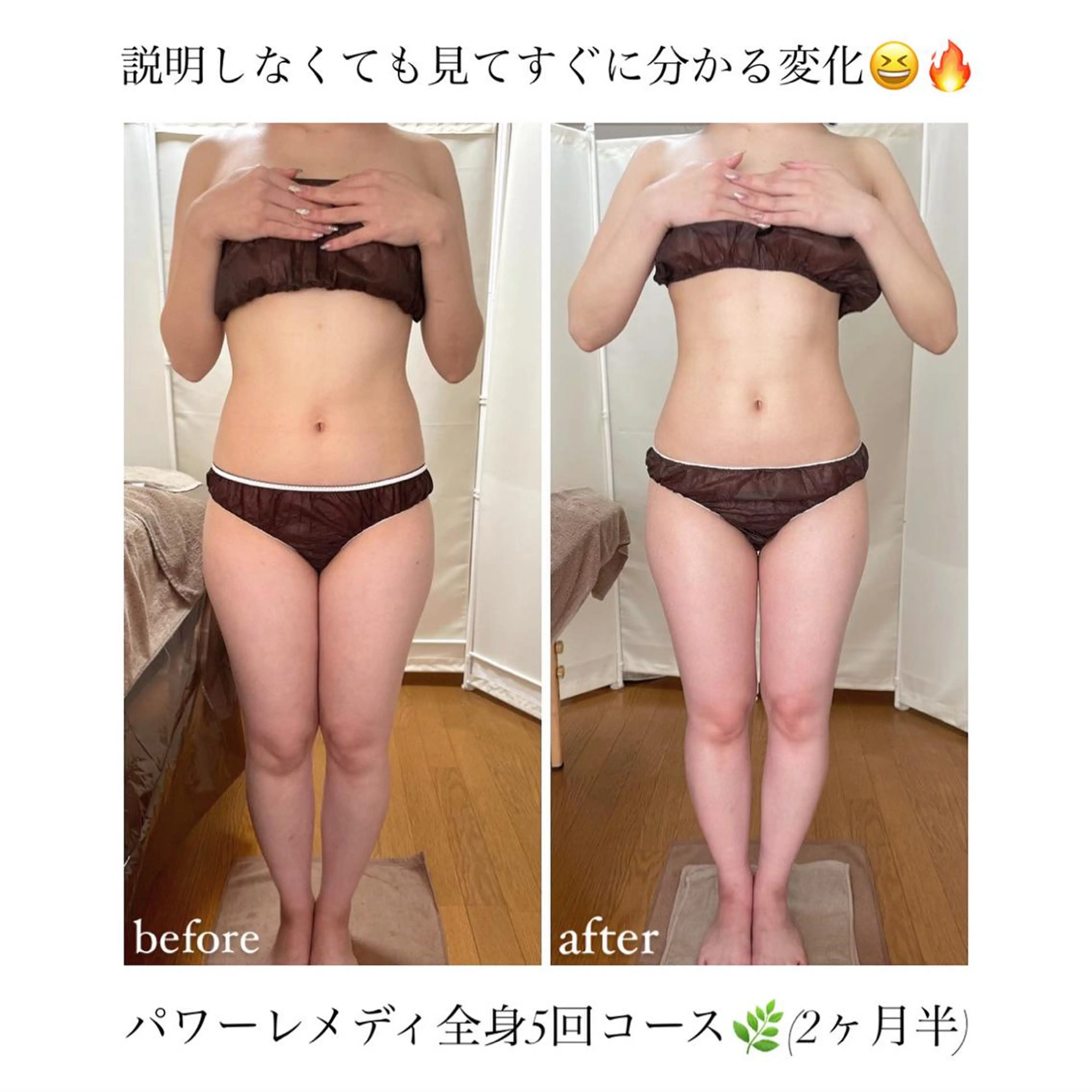 《本気痩せ×疲労改善 》  BILOOPのエステ・リラクイメージ