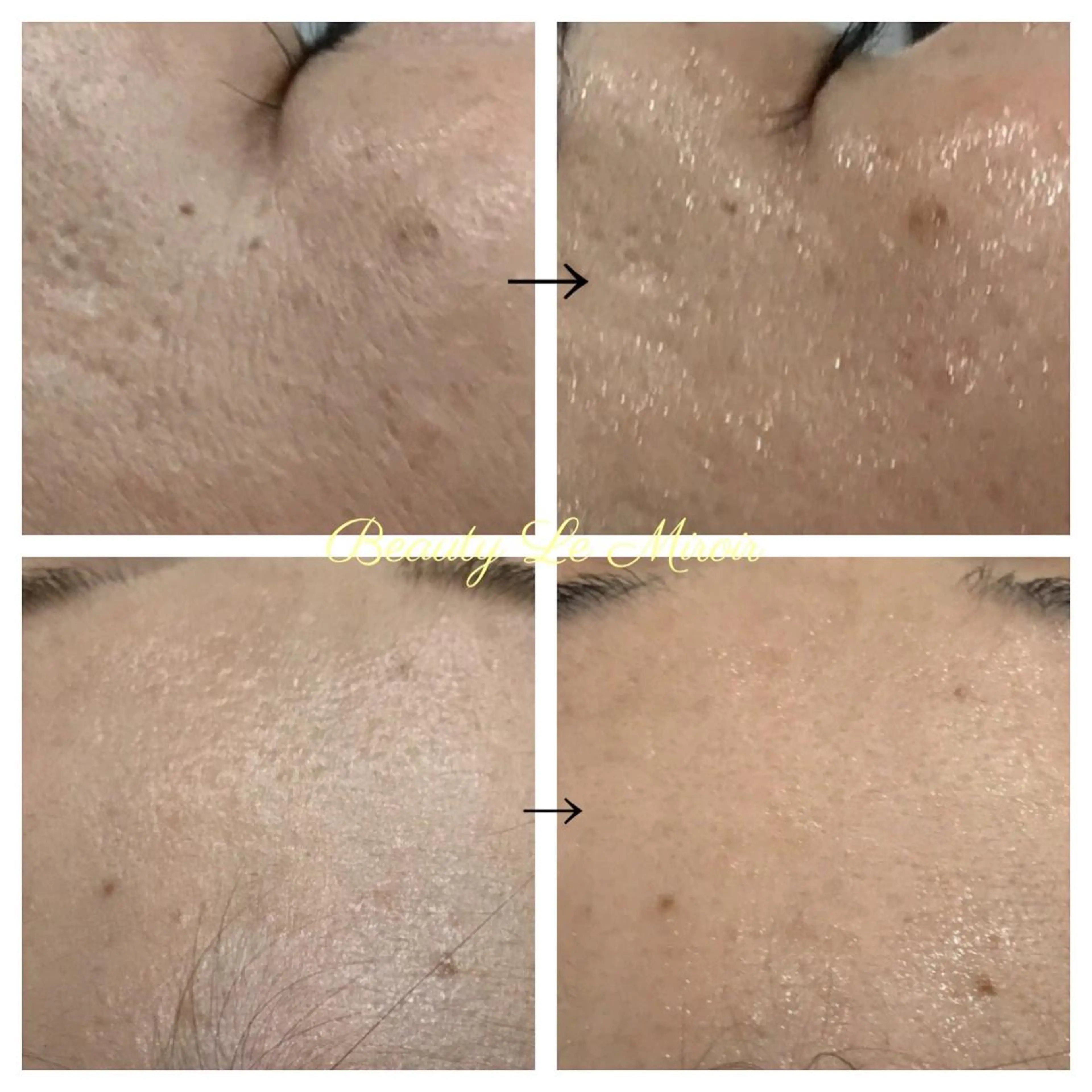 ビューティー ミロワールのエステ・リラクイメージ