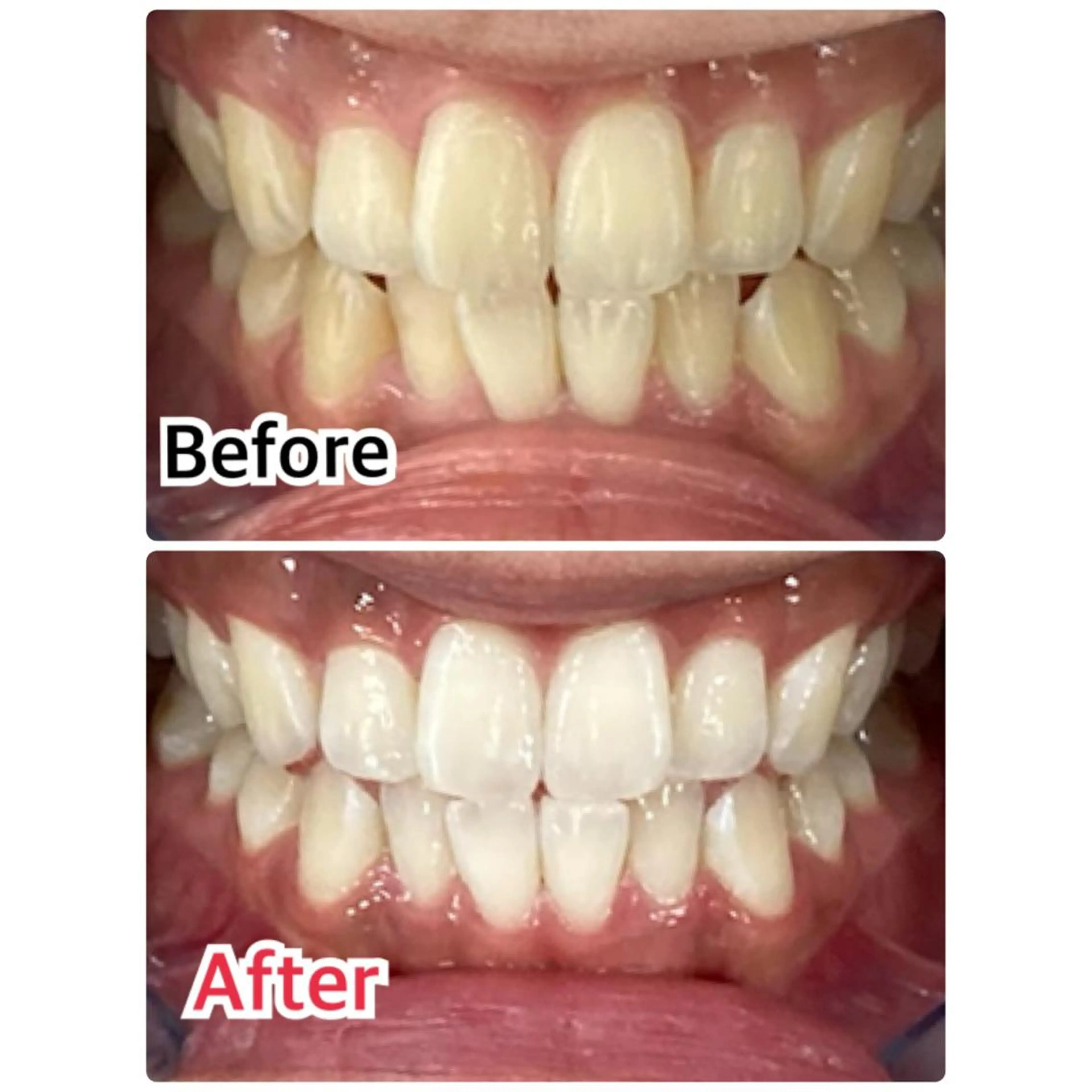 プラチナムビューティー柏所属・【歯科提携】柏ホワイ トニングスタイルのその他イメージ