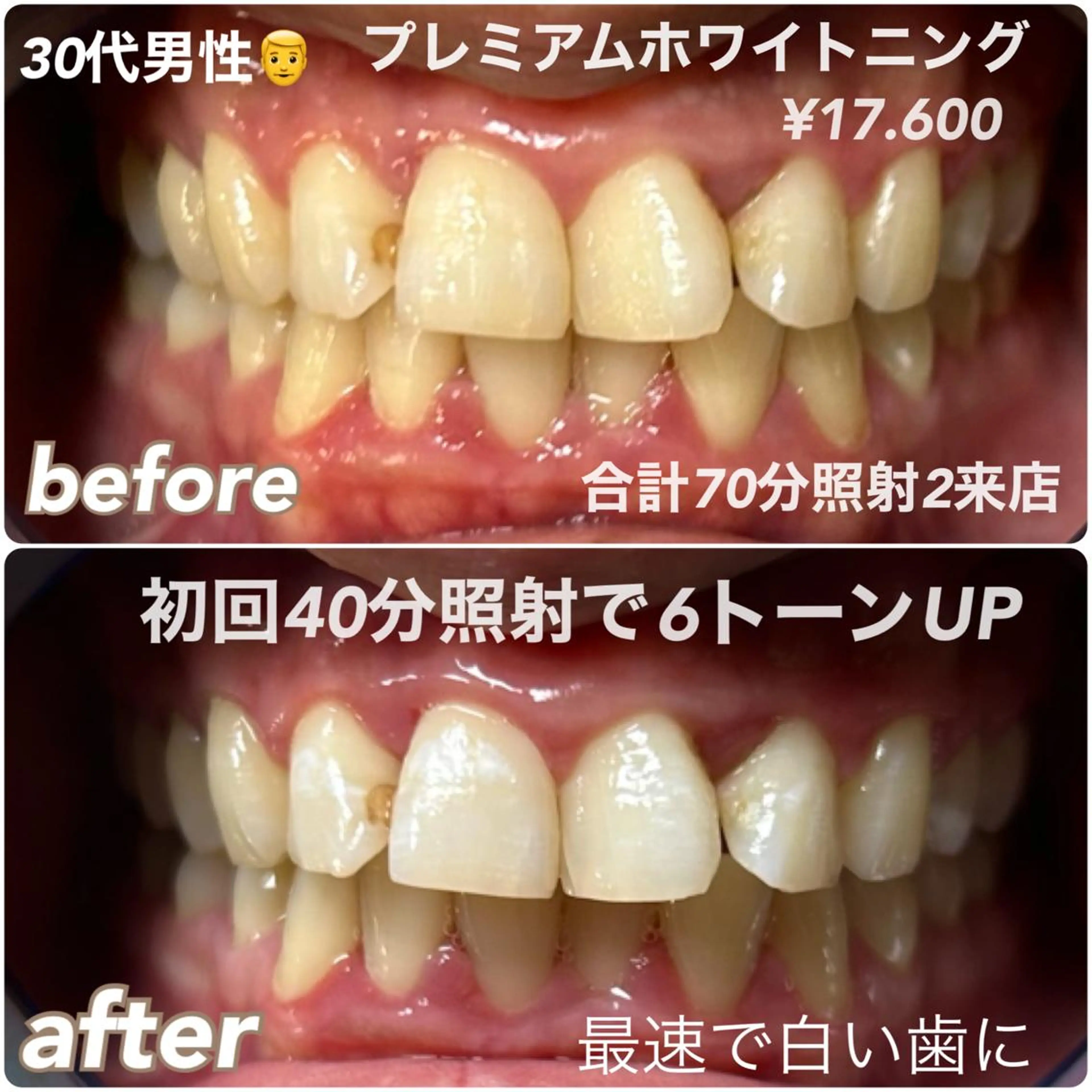 ホワイトニングビュー ティー西宮店のその他イメージ