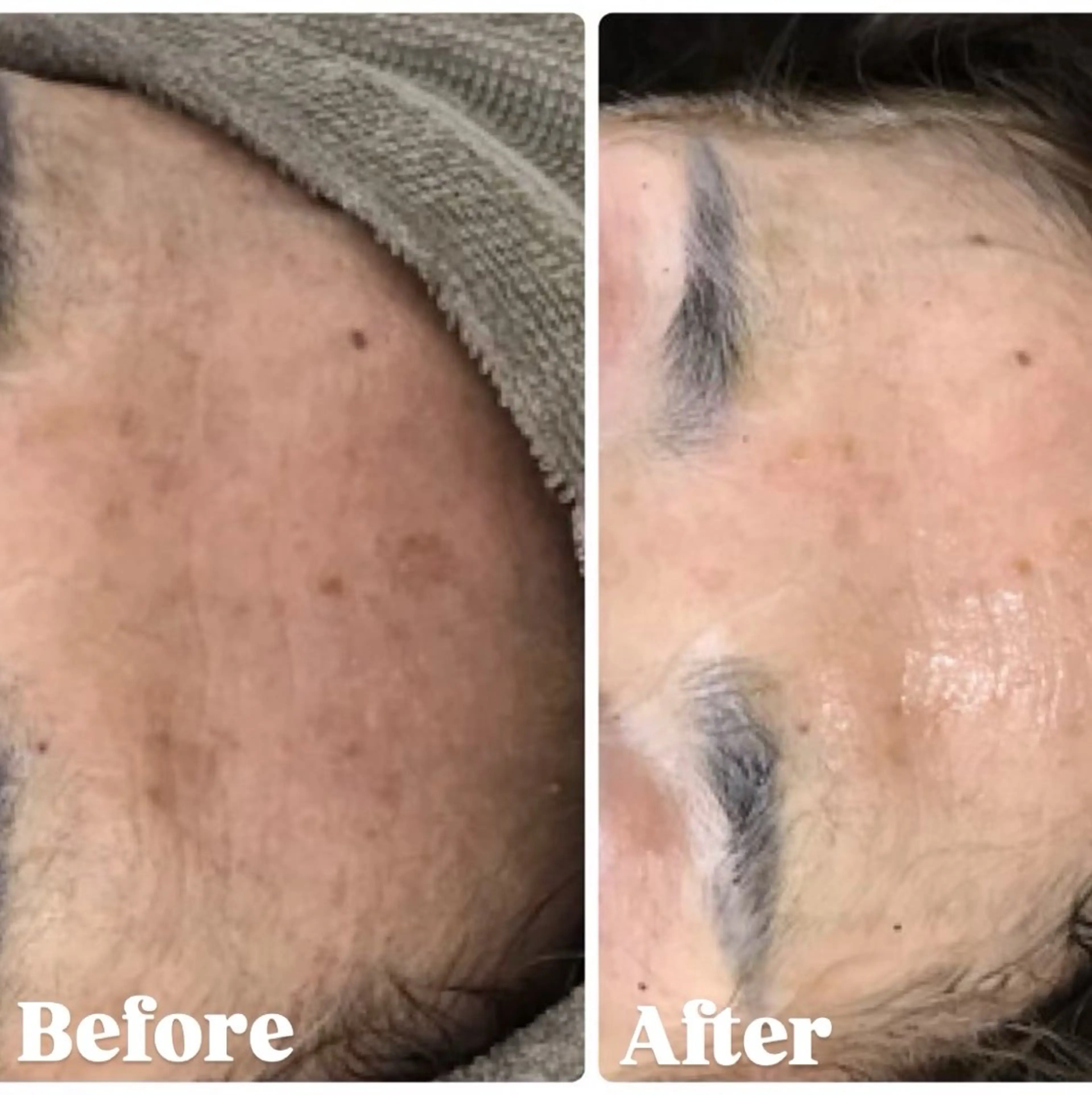 その他 アロマ•ピーリング SalonYokoのその他イメージ