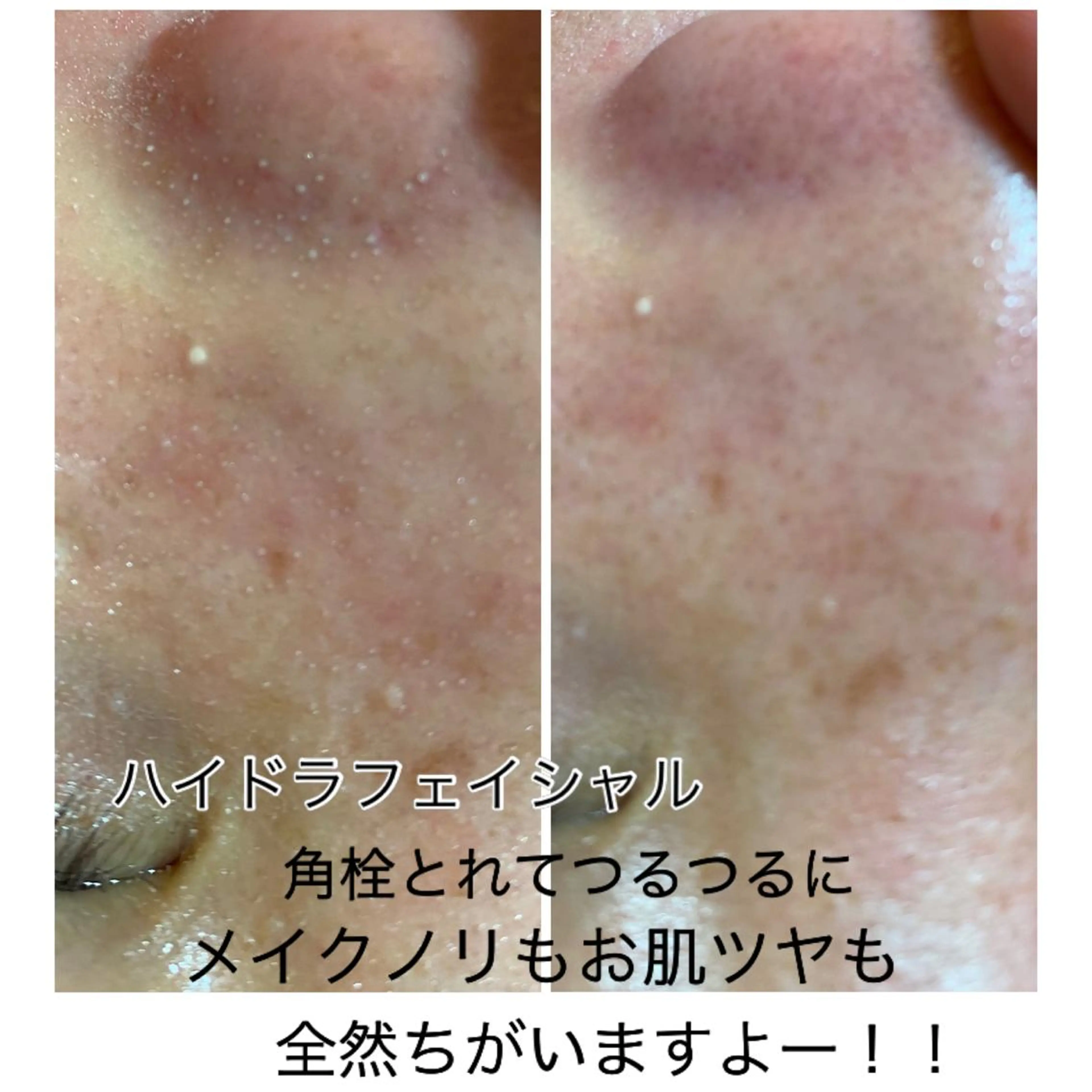 エステ プリート毛穴洗浄美肌 Pulitoのエステ・リラクイメージ