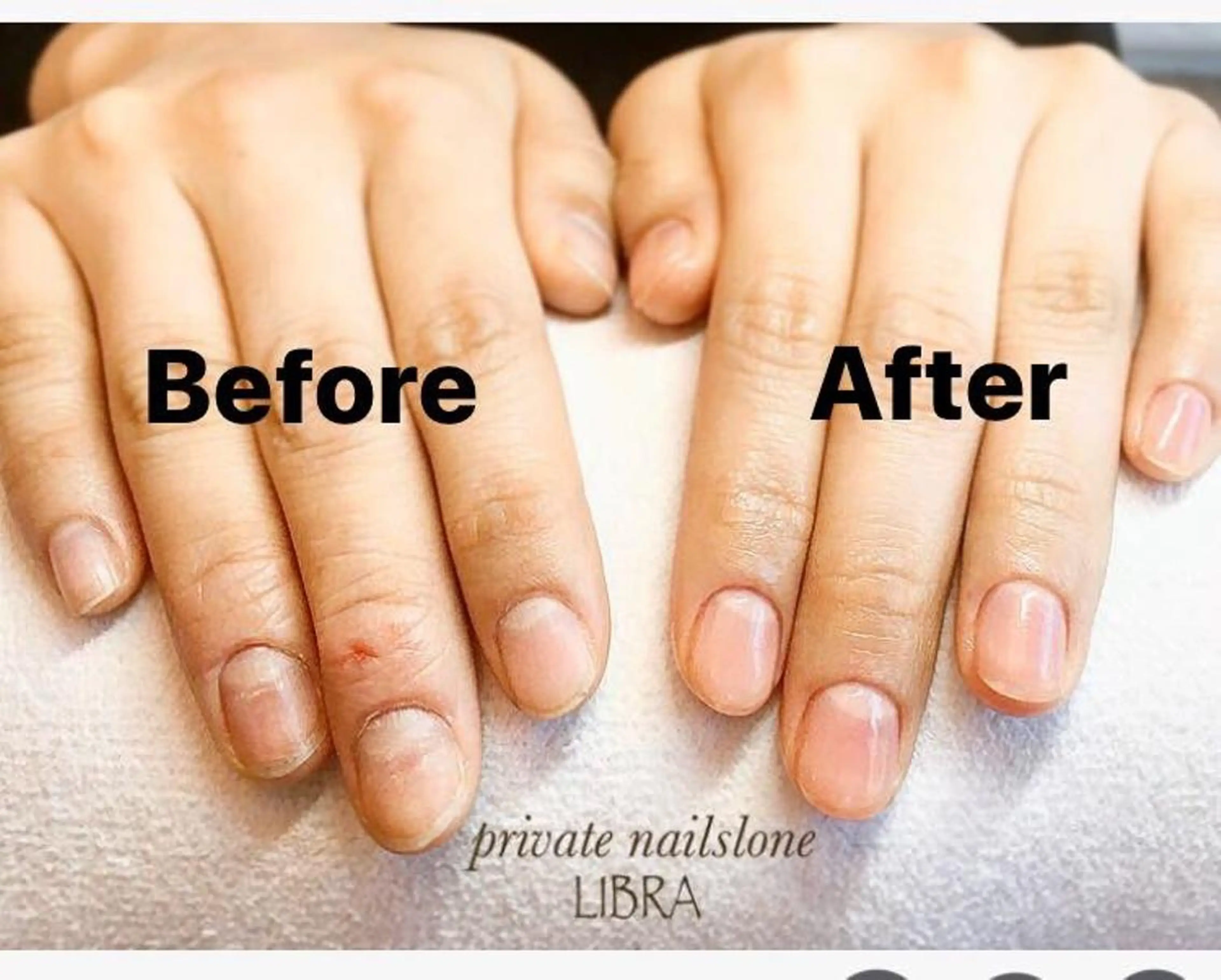 ネイルケア💅✨ネイル初めてさんやジェルネイルが出来ない方におススメ☆自爪の形成→甘皮処理→軽いハンドマッサージの写真