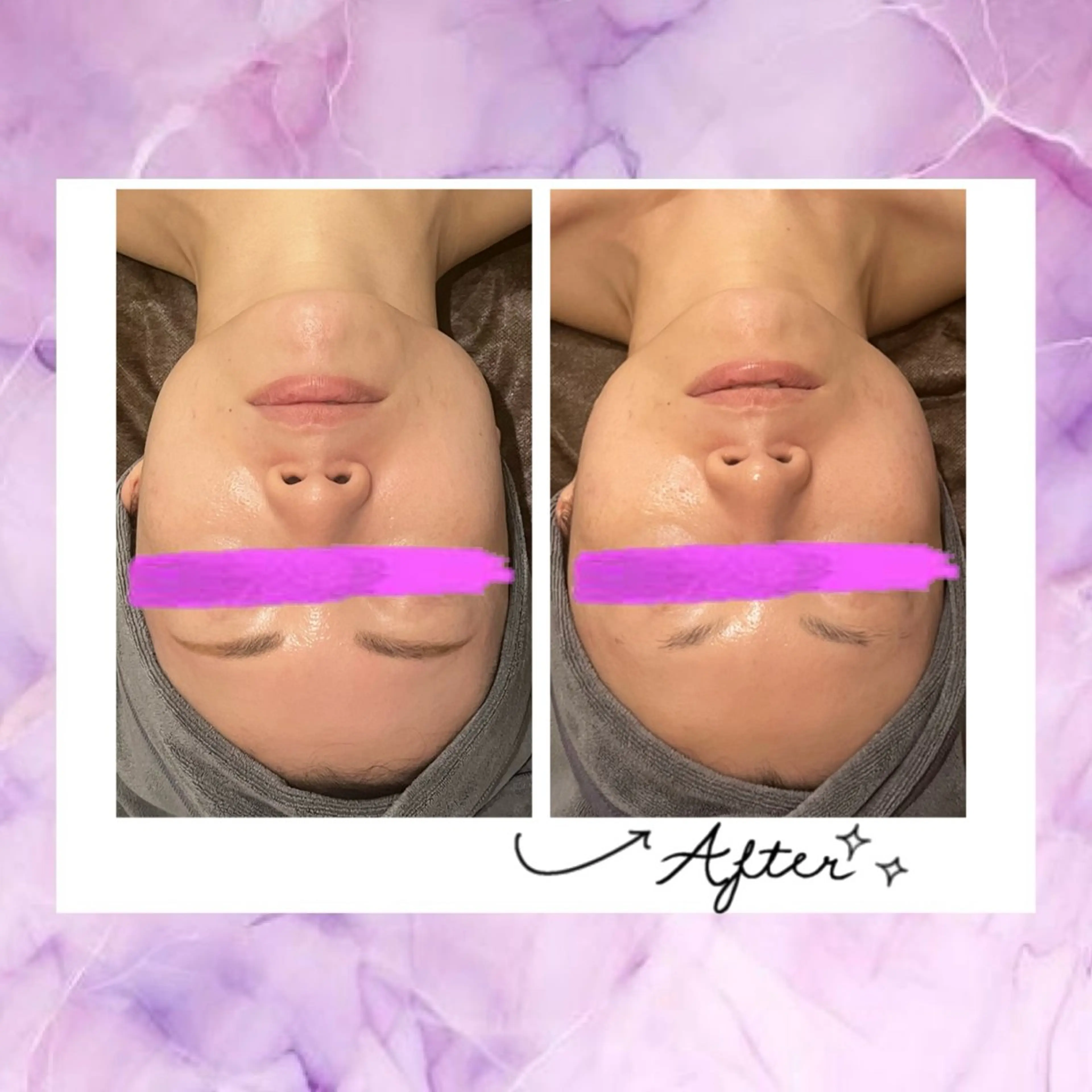 エステ 小顔コルギ ☆表参道/外苑前のエステ・リラクイメージ