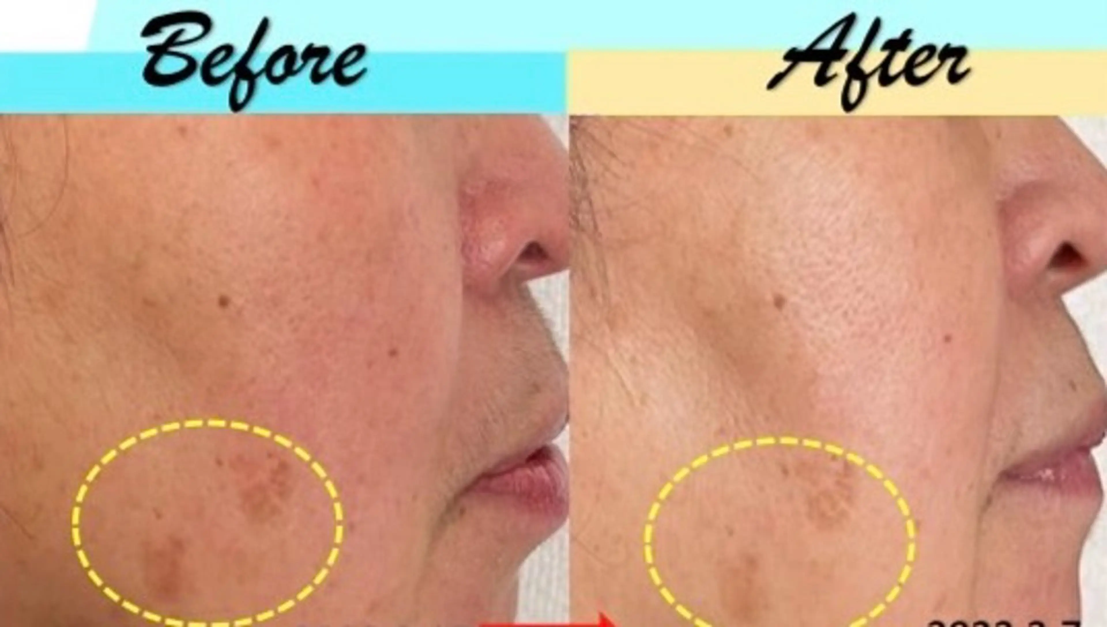 エステ Alluring（アルーリング）所属・Alluring アルーリング中村のエステ・リラクイメージ