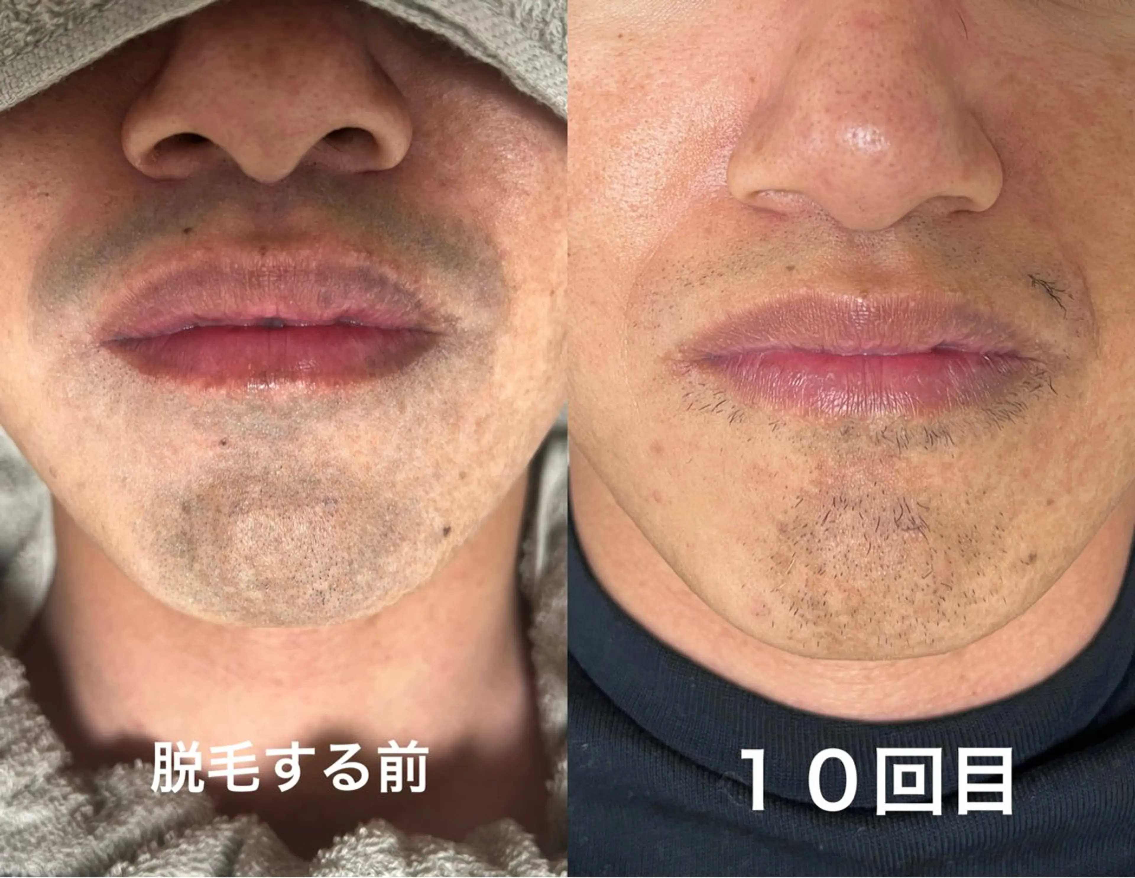 メンズ Akala miのエステ・リラクイメージ