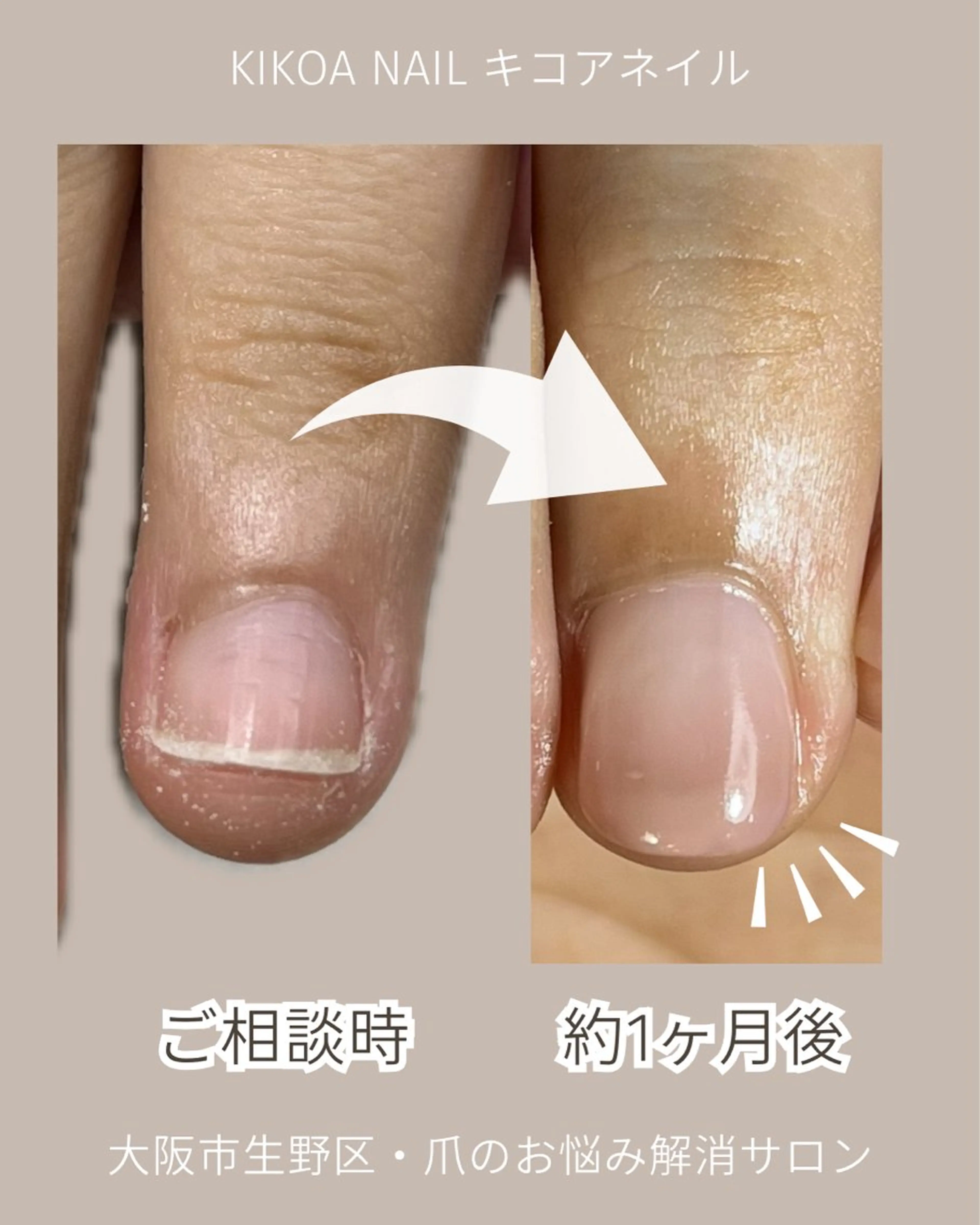 ネイル ジェルネイル KIKOA NAIL キコアネイルのネイルデザイン