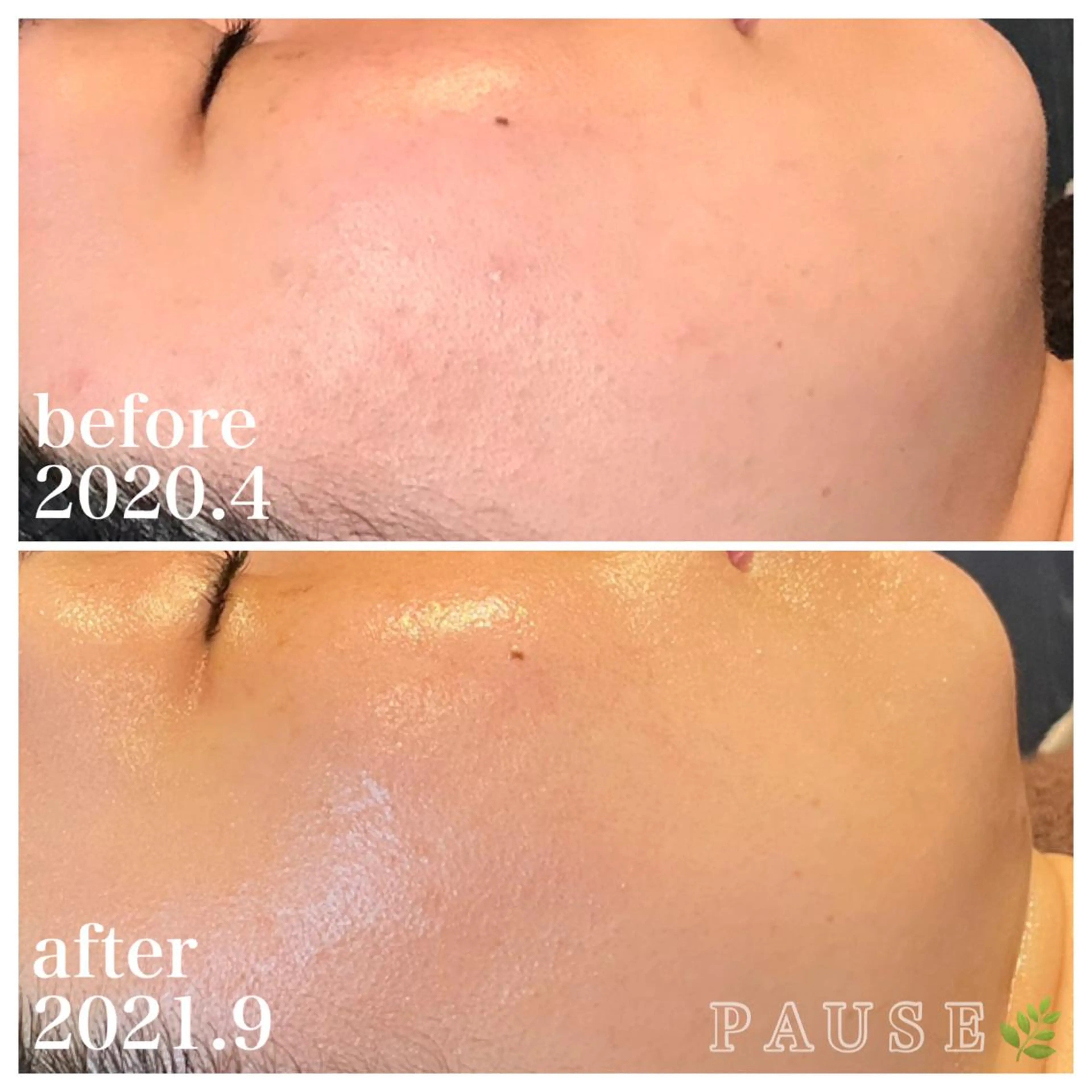 エステ 浜野 恵美のエステ・リラクイメージ