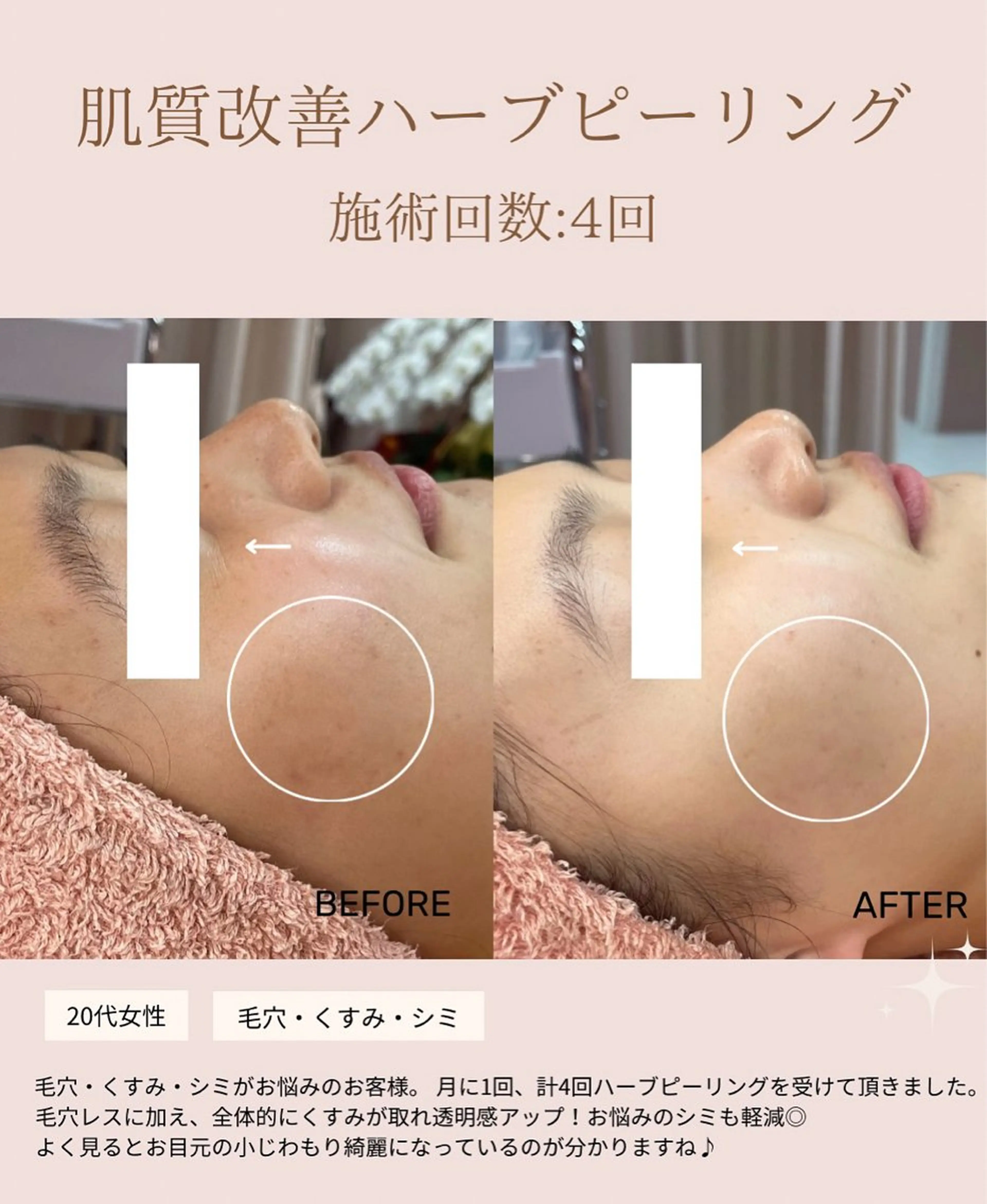 肌質改善専門サロン Bellmi/心斎橋のエステ・リラクイメージ