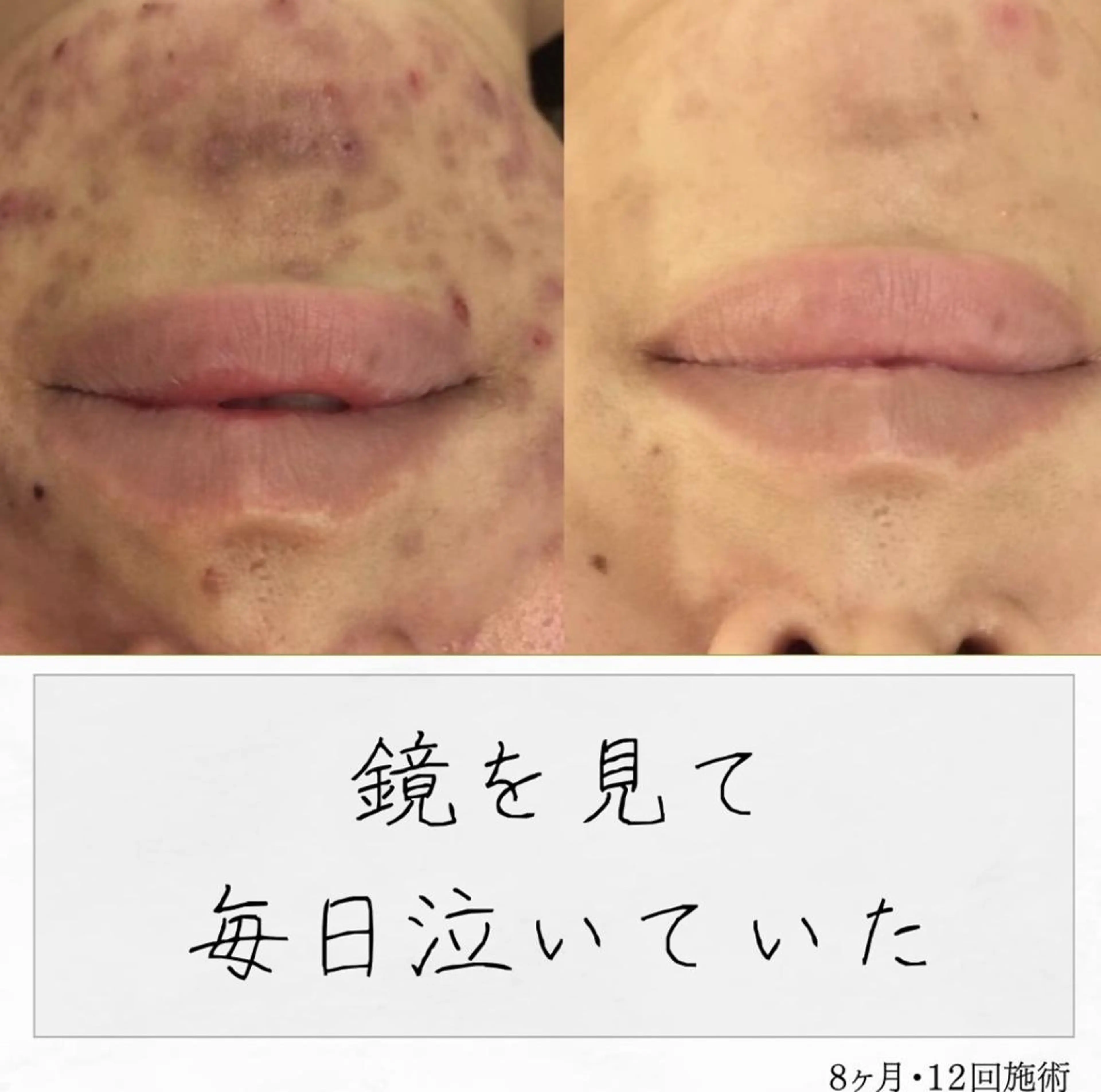 ニキビ経験者が施術 する専門サロン🌻のエステ・リラクイメージ