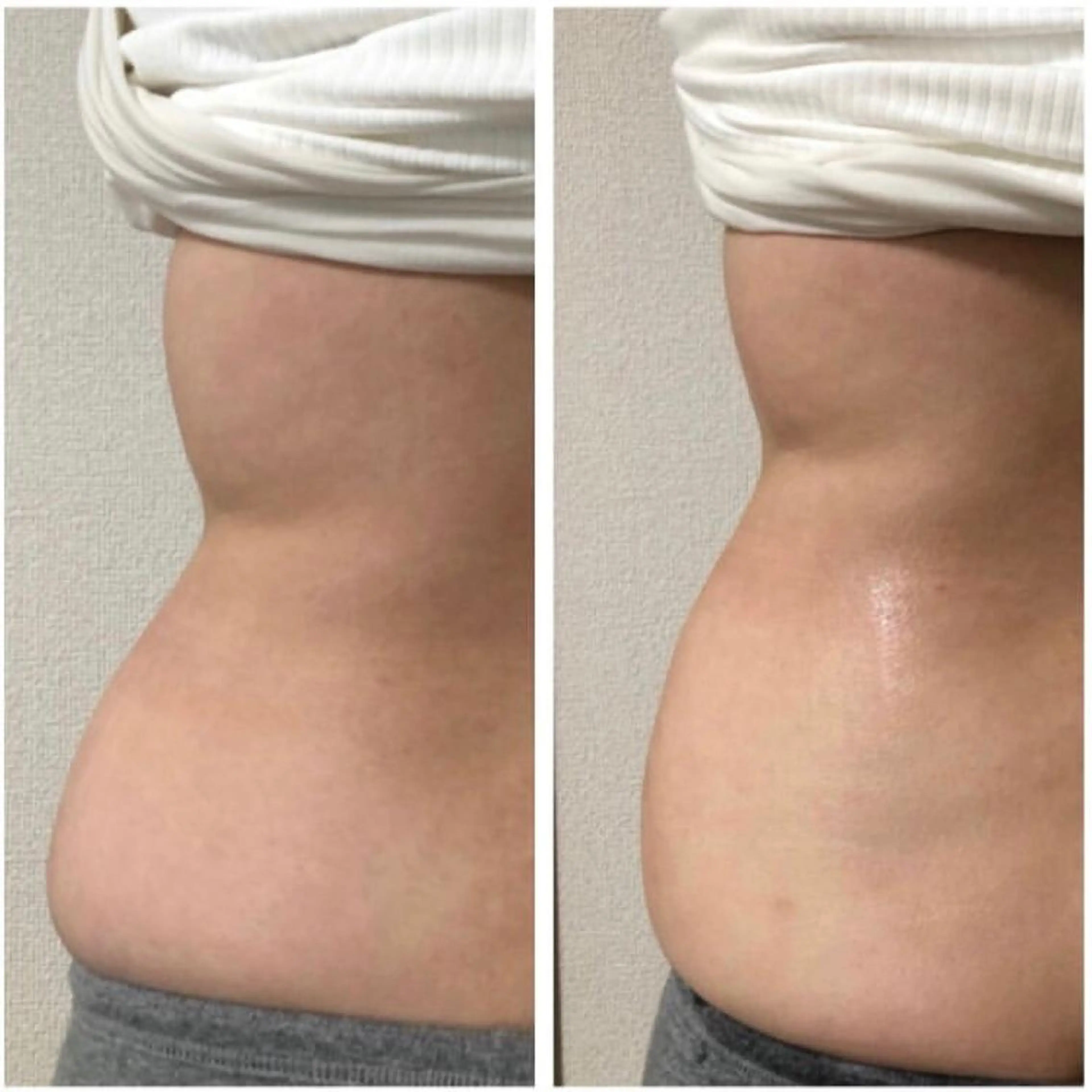 【美容整形級エステ】 服部隆美のエステ・リラクイメージ