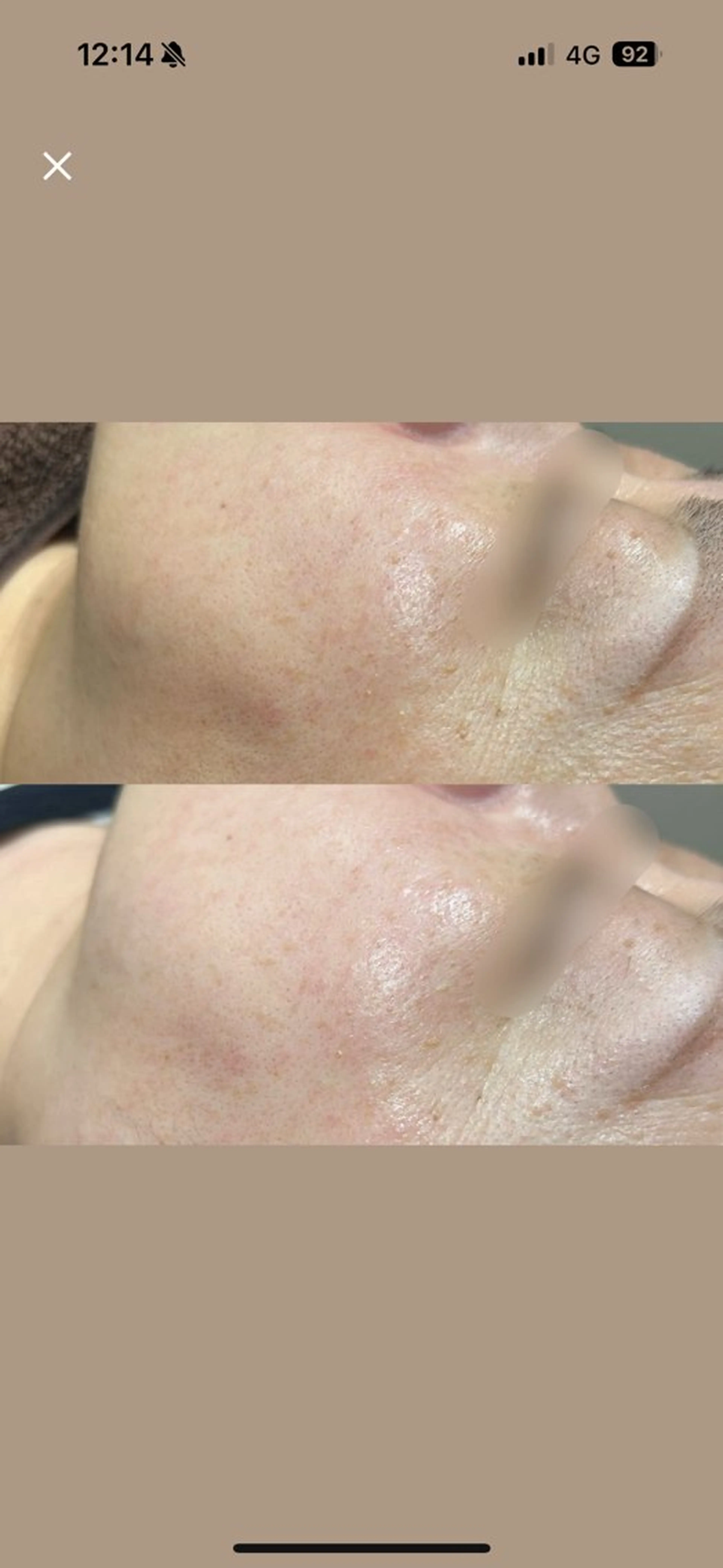 エステ 🎀RIA🎀 脱毛/フェイシャルのエステ・リラクイメージ