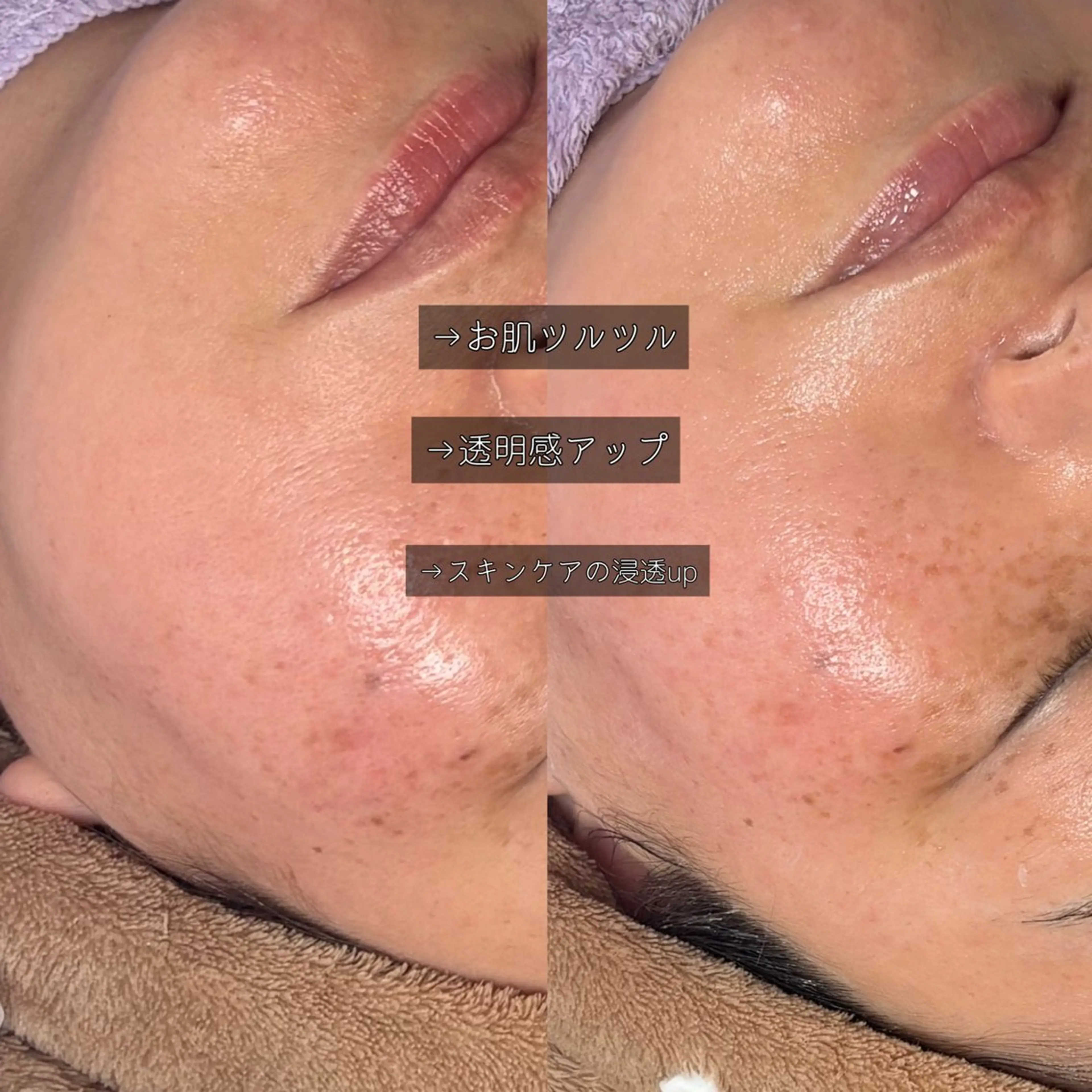 エステ まつげと艶肌 サロンのエステ・リラクイメージ