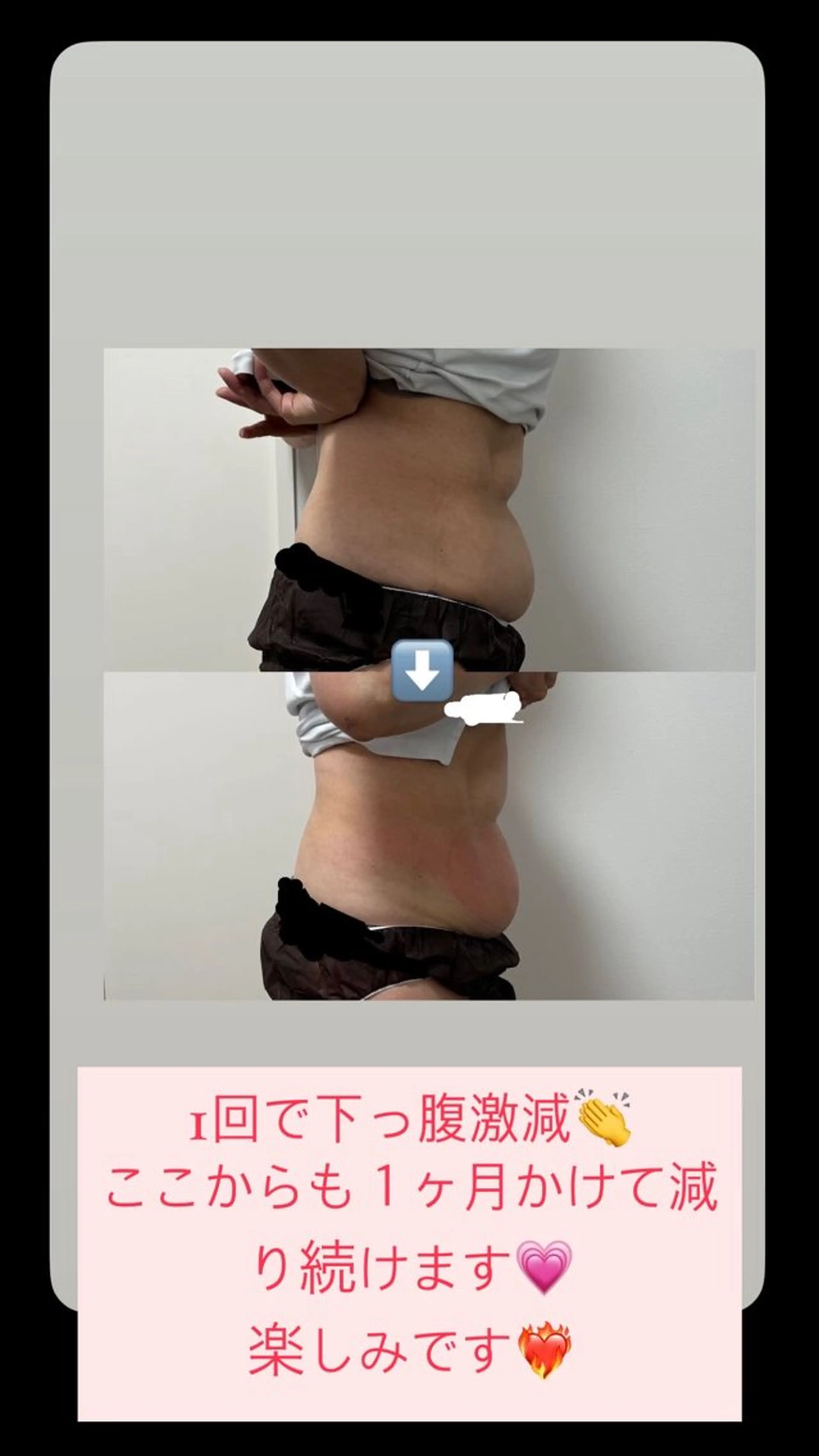 エステ Miiju.所属・石巻 冷却痩身 Miiju. 鈴木のエステ・リラクイメージ