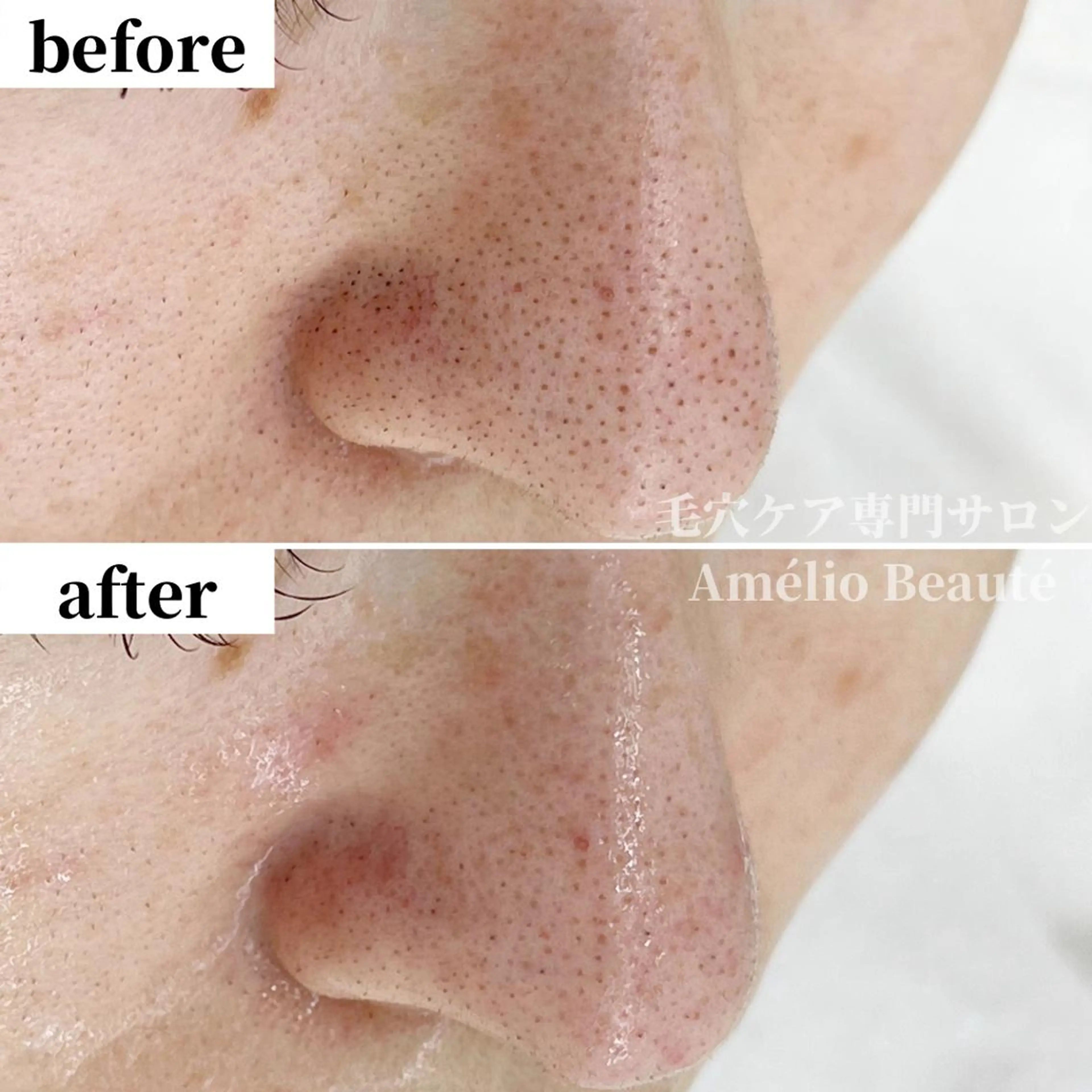 毛穴ケア専門サロン アメリオボーテのその他イメージ