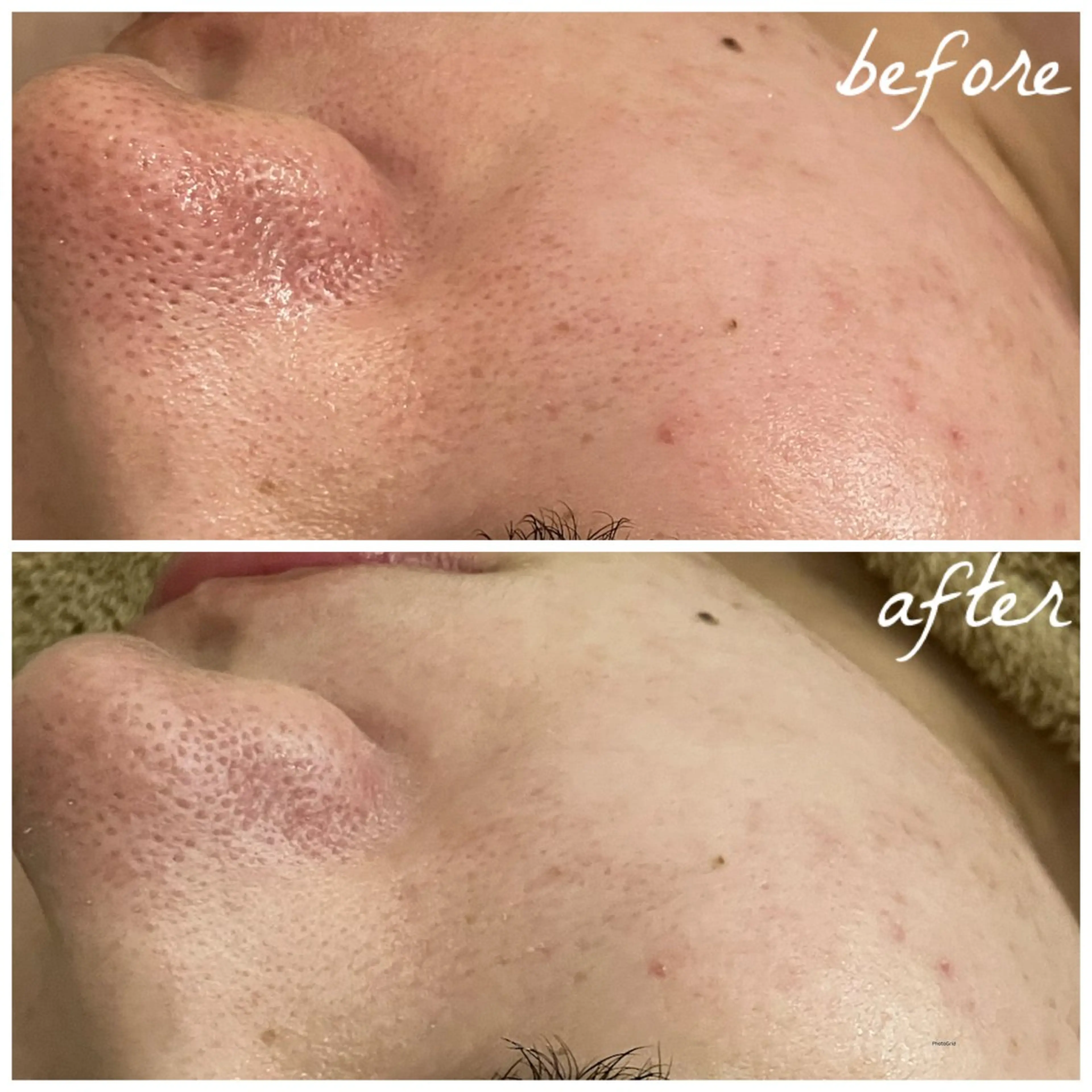 メンズ メナード岐阜市茜部 杉浦のエステ・リラクイメージ