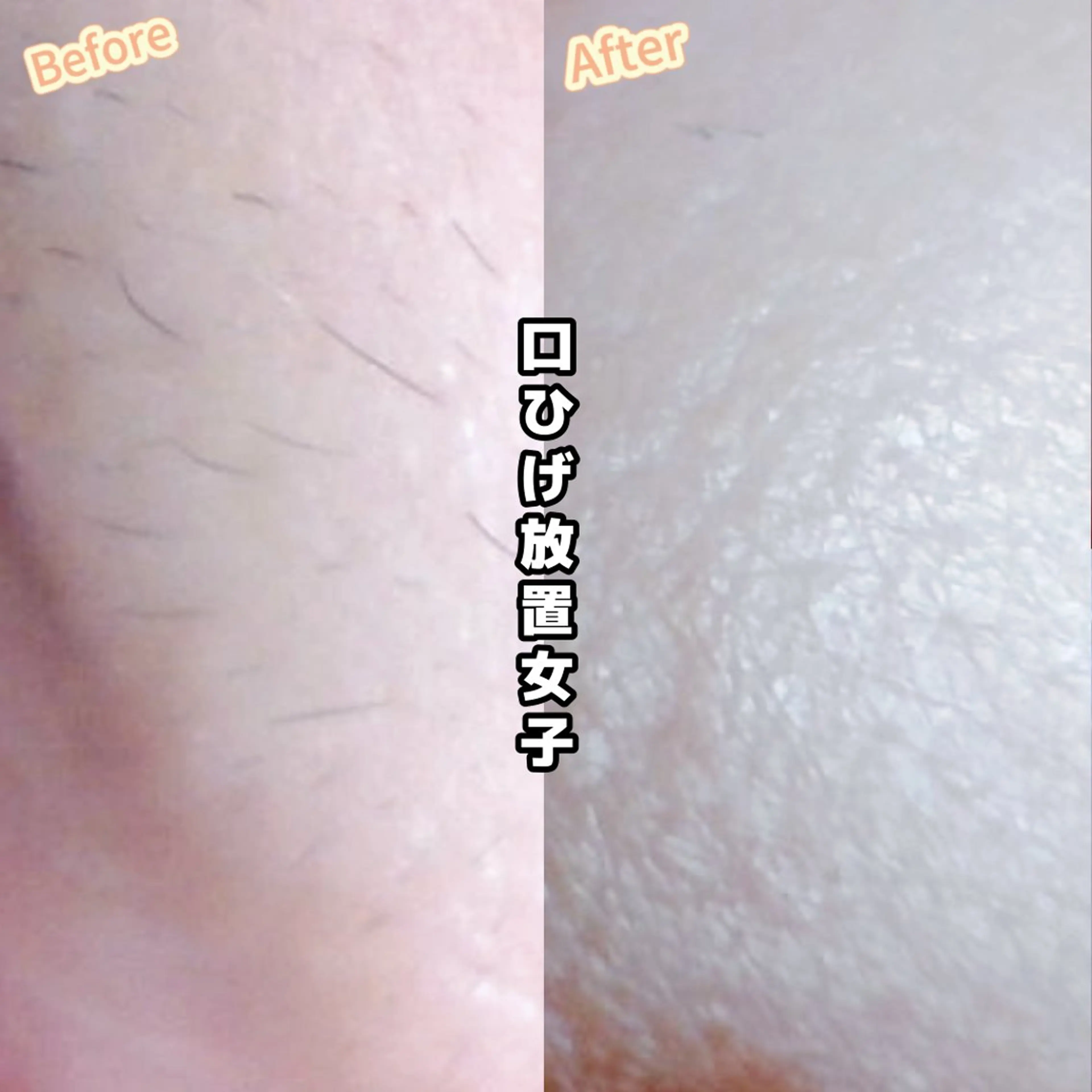 Hitomi シュガーリング豊橋のその他イメージ