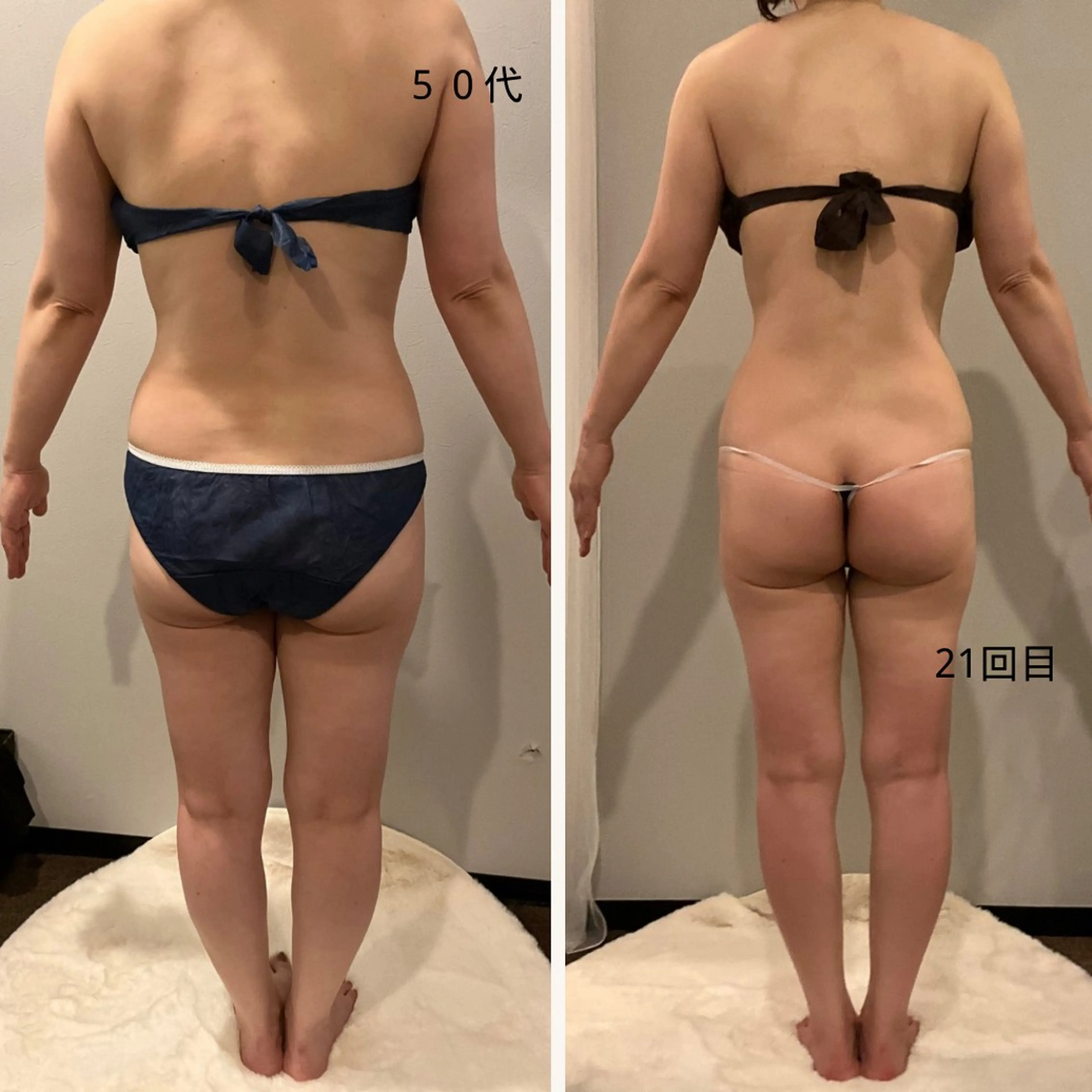 ✨痩身 ✨ハイパーナイフEXのエステ・リラクイメージ