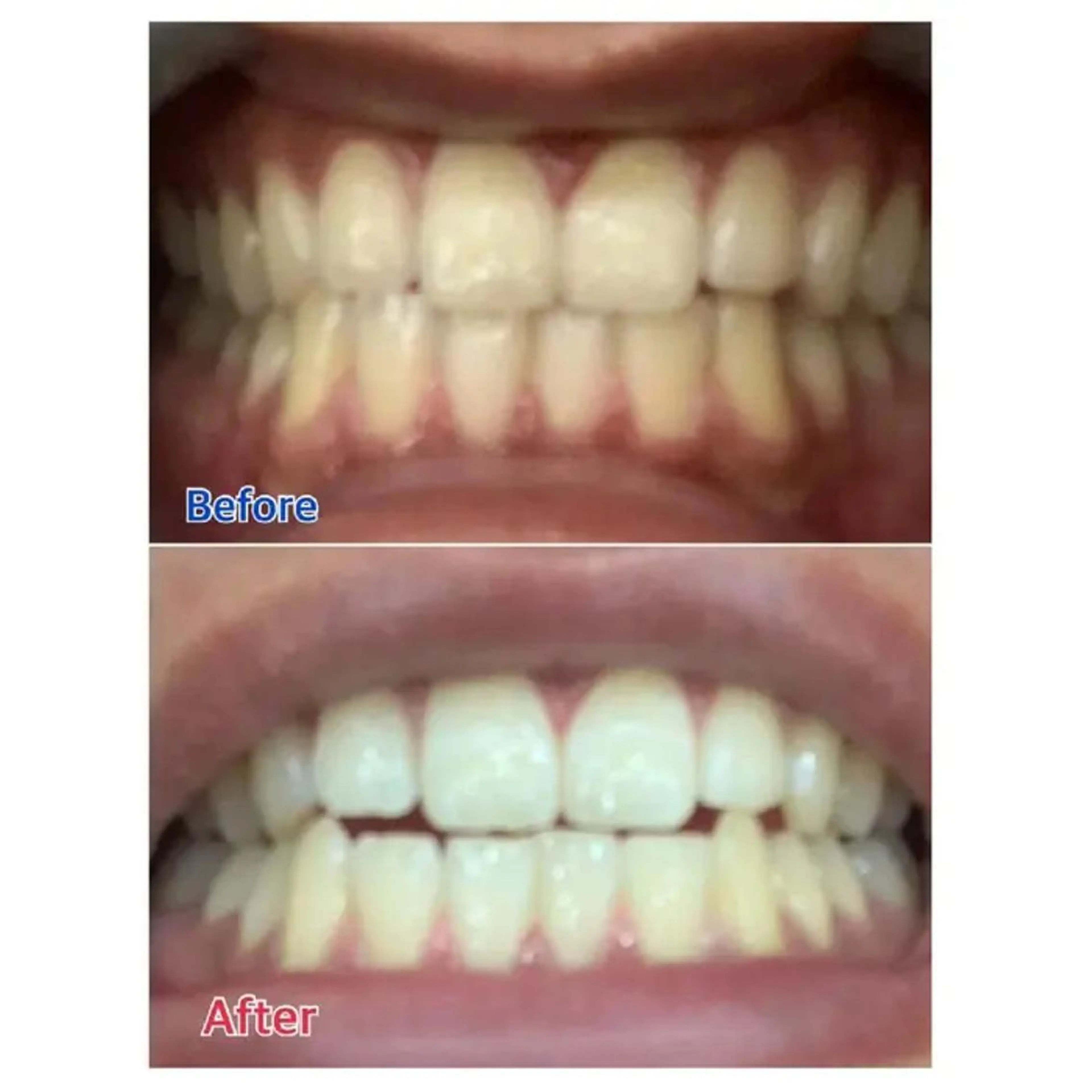 M渋谷 ホワイトニングのその他イメージ