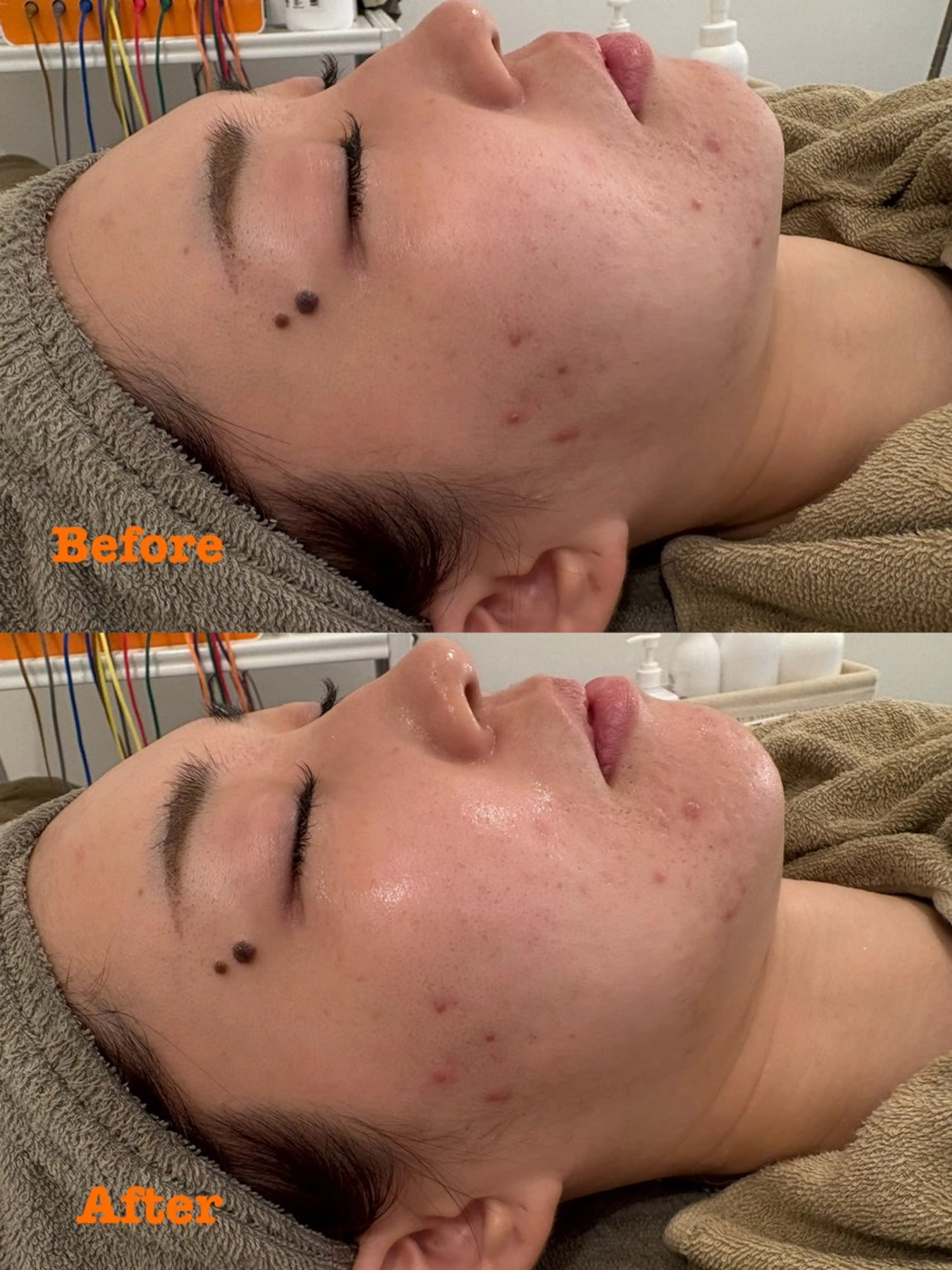 鍼灸サロン mahorobaトモのエステ・リラクイメージ