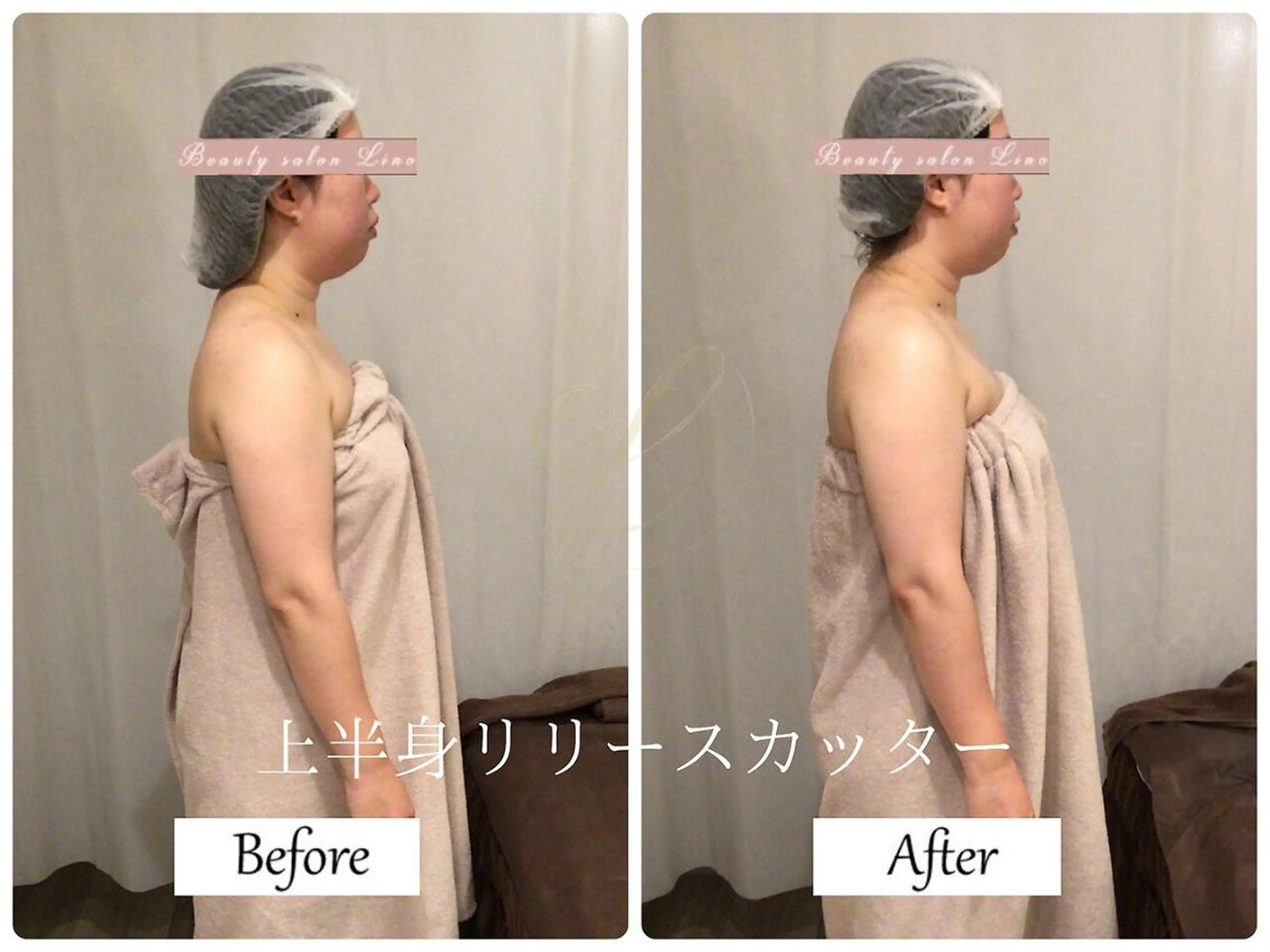 ブライダルサロン ｜Lino【堀江】のエステ・リラクイメージ