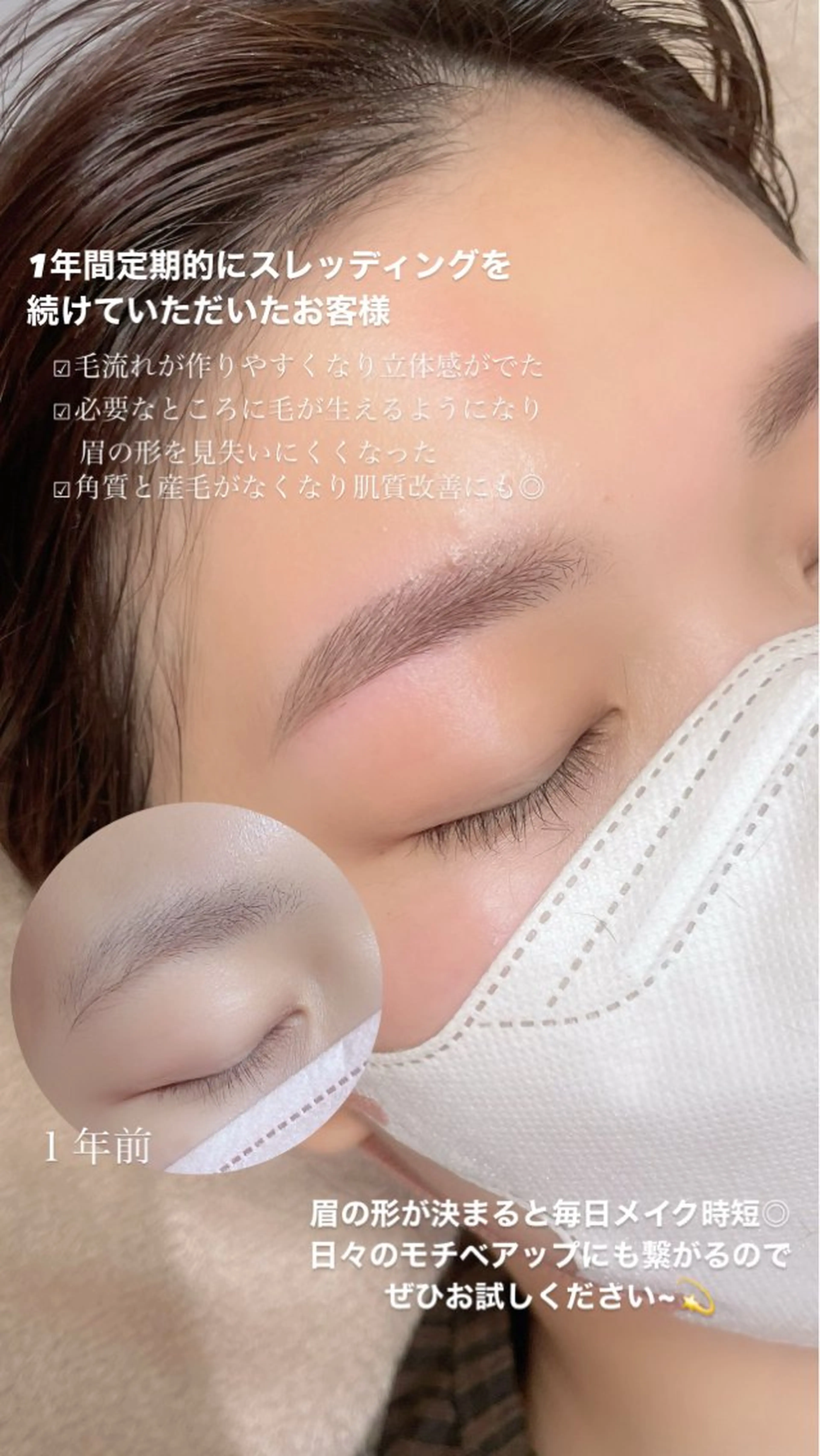 平日13-16限定　顔脱毛の写真