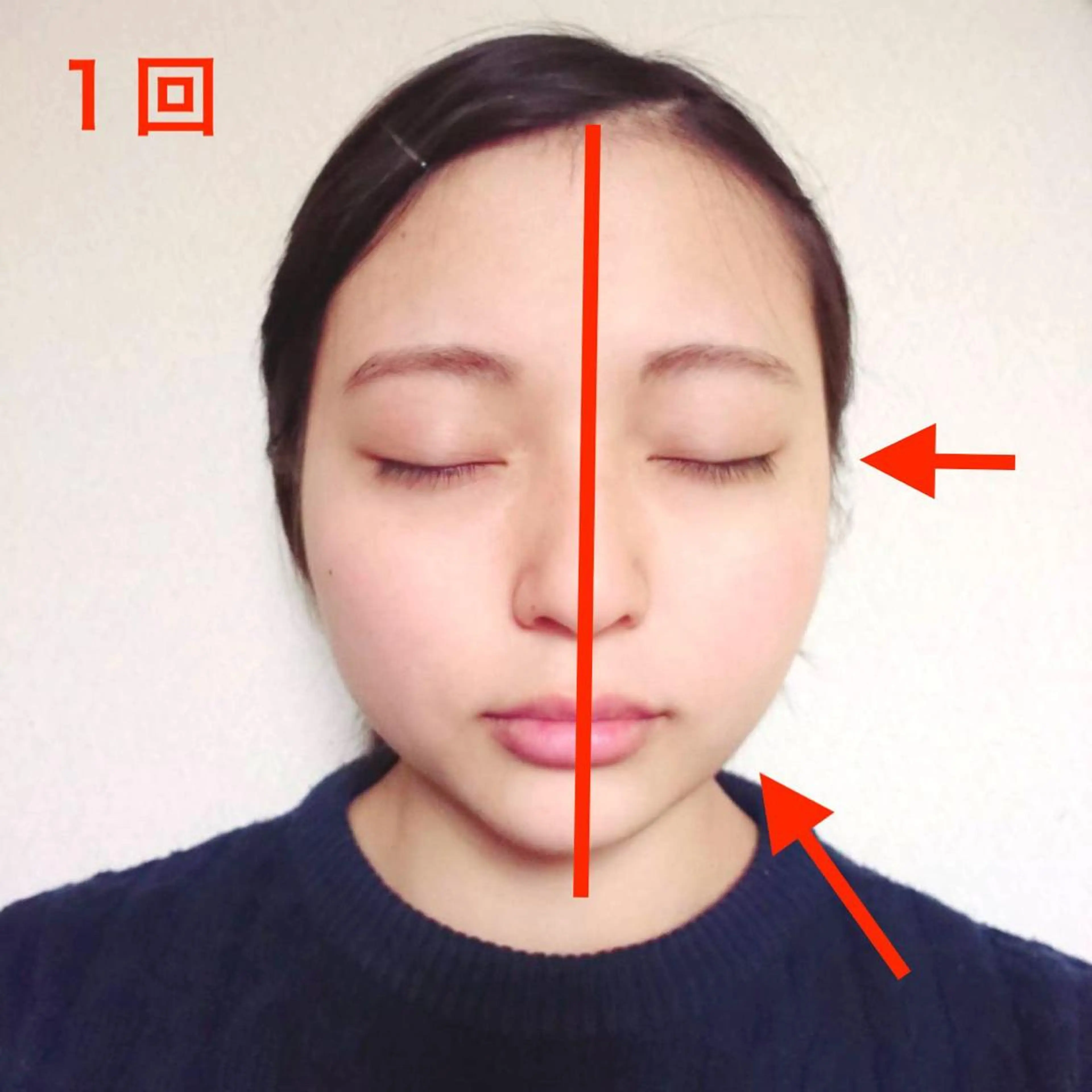 1月限定【超音波小顔痩身】4000shot＋毛穴ケア＋EMSが￥6500⭐︎日本製の最新型超音波マシン使用の写真