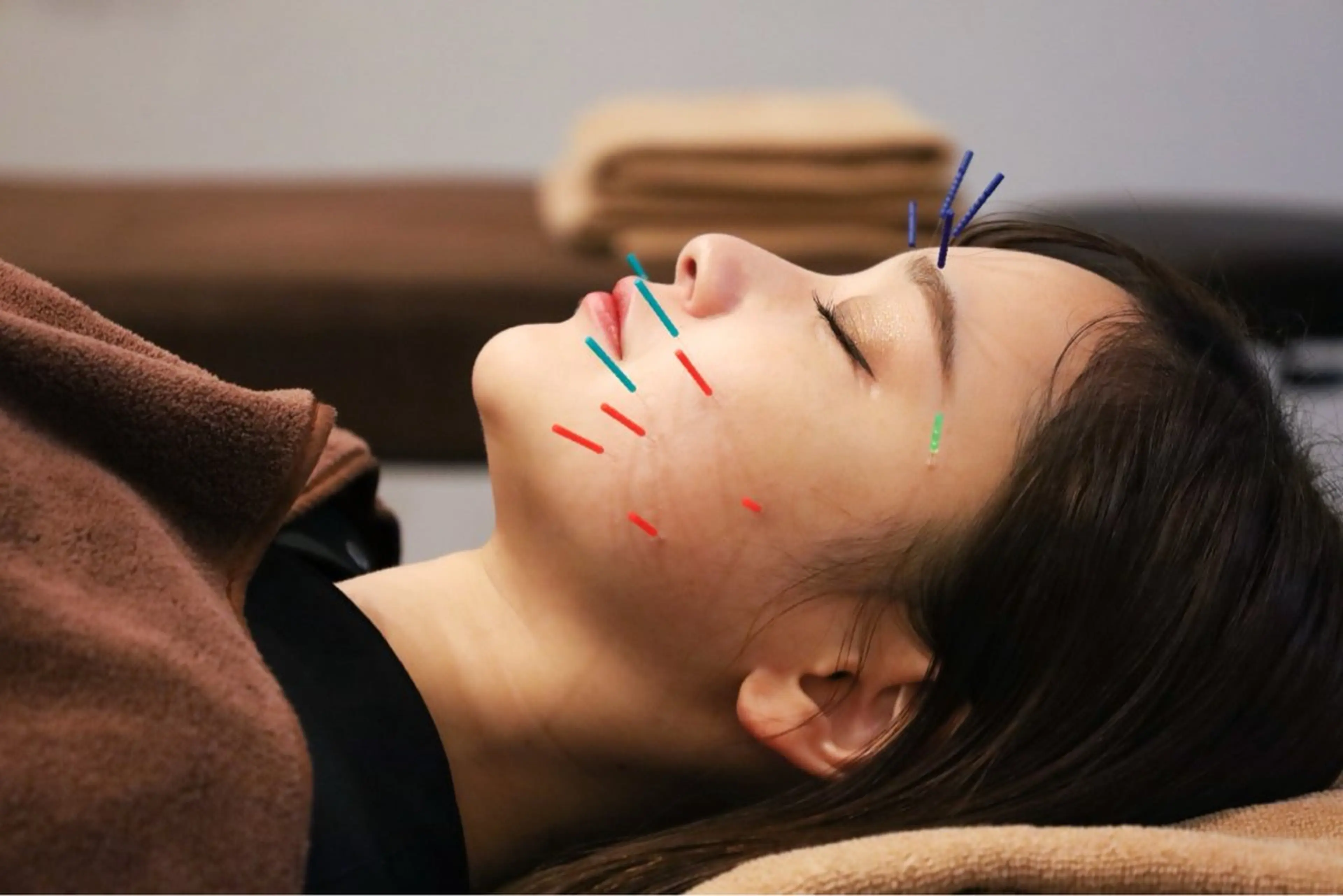 エステ リラク 美容鍼×小顔矯正× 美容整体/小林幸司のエステ・リラクイメージ