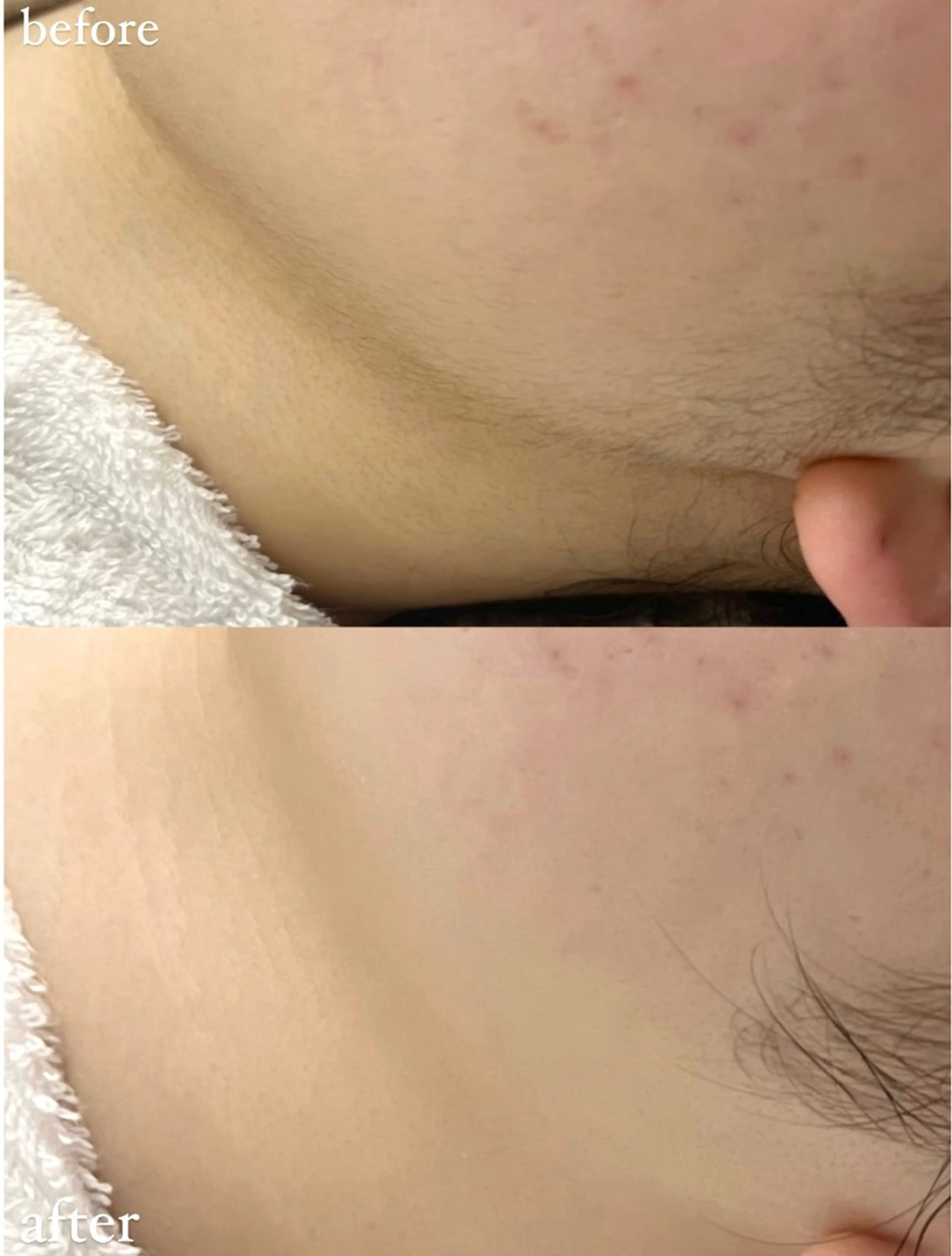 女性専門お顔剃り sunraineのエステ・リラクイメージ