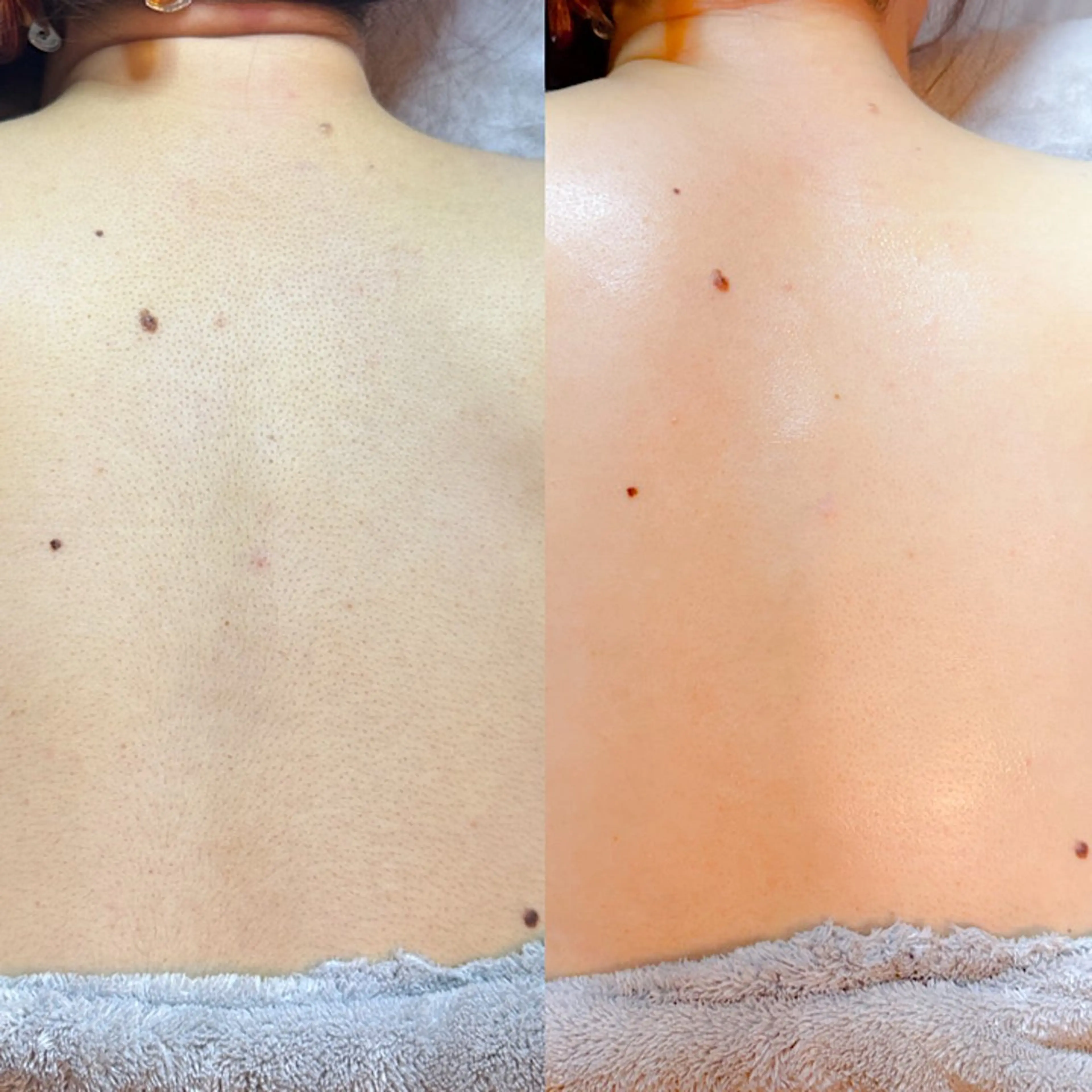 Hitomi シュガーリング豊橋のその他イメージ