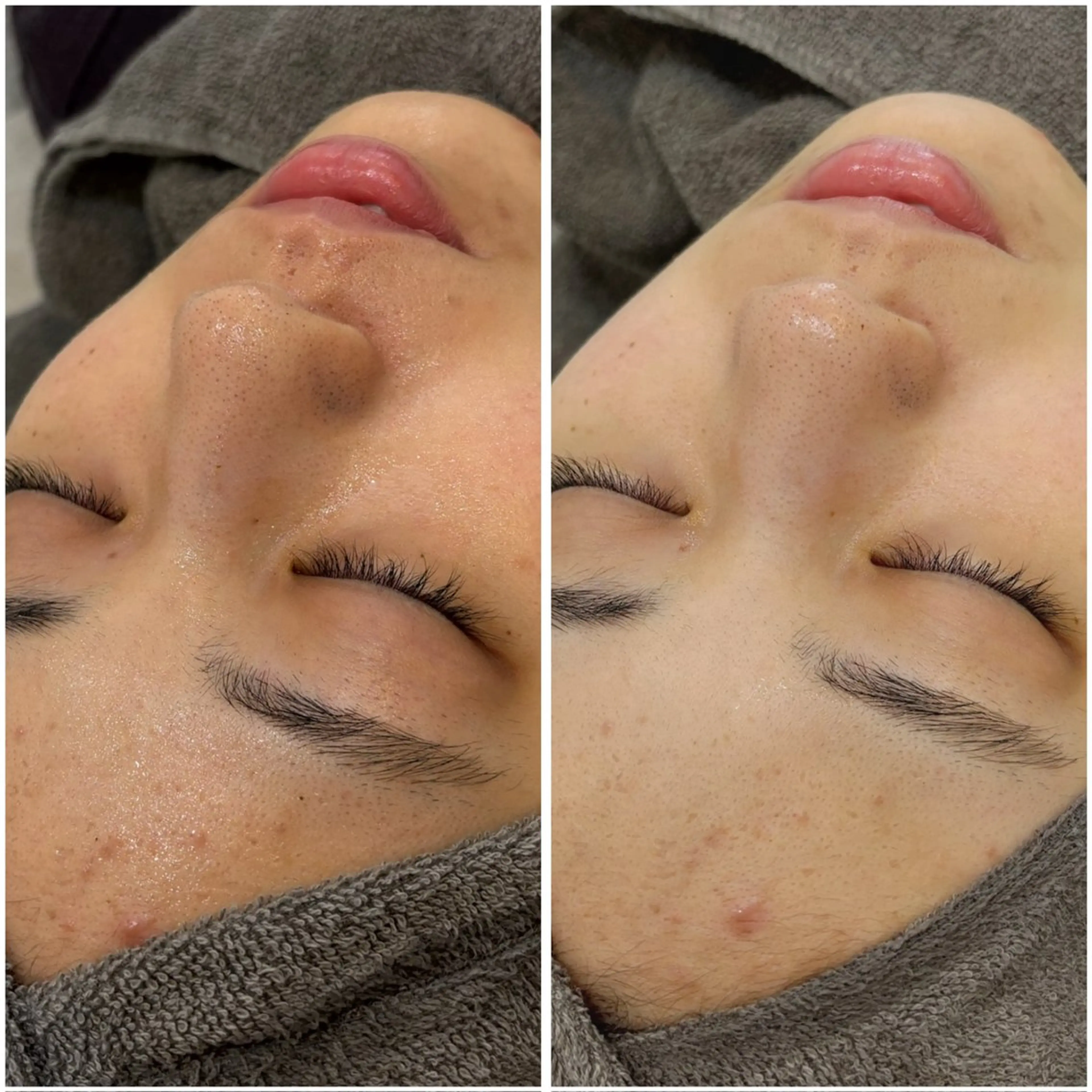 艶肌デトックス🫧 Samiraのエステ・リラクイメージ