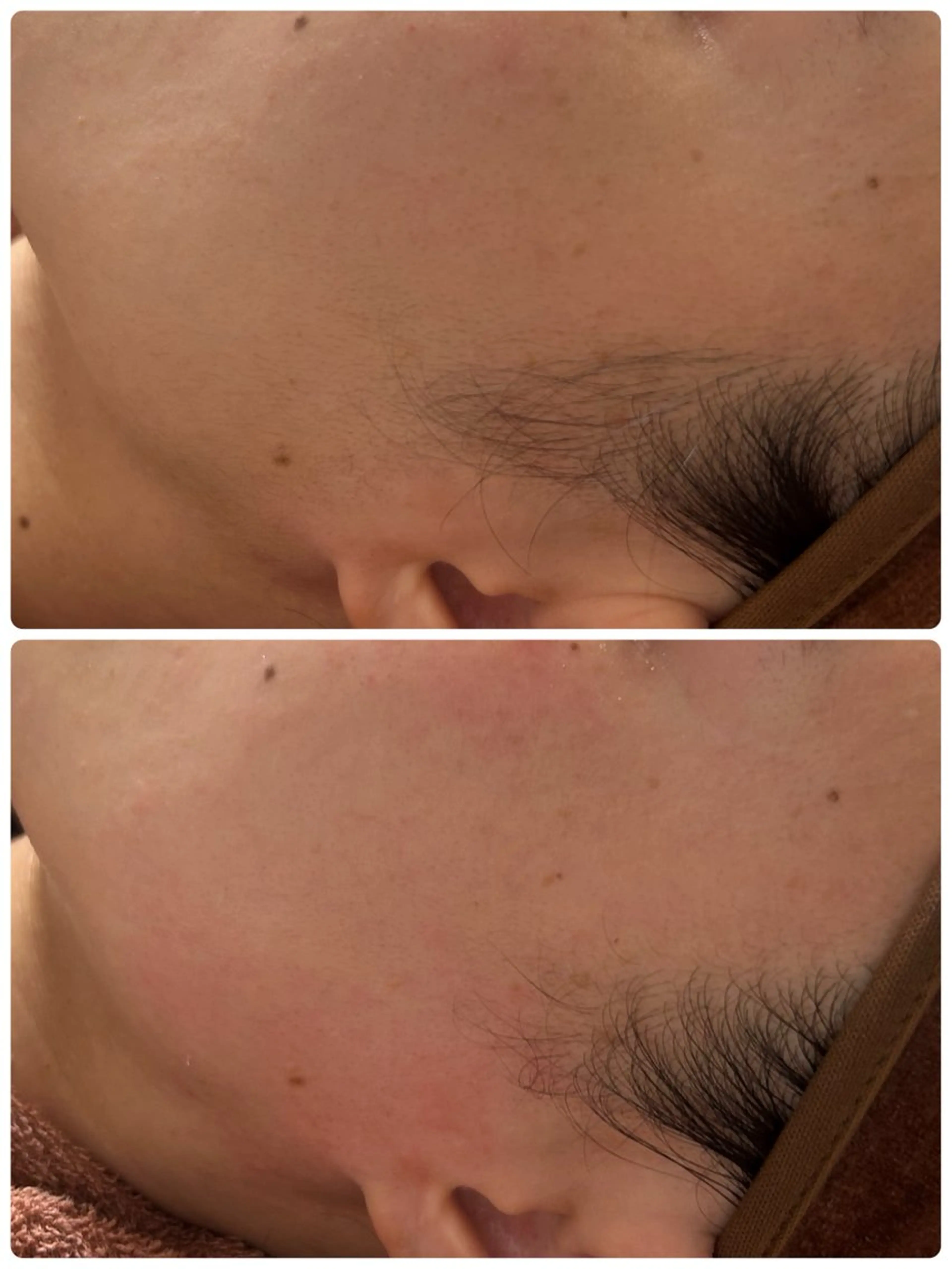 エステ beauty  salon sorelle所属・産毛角質ケア/艶肌 フェイシャルワックスのエステ・リラクイメージ