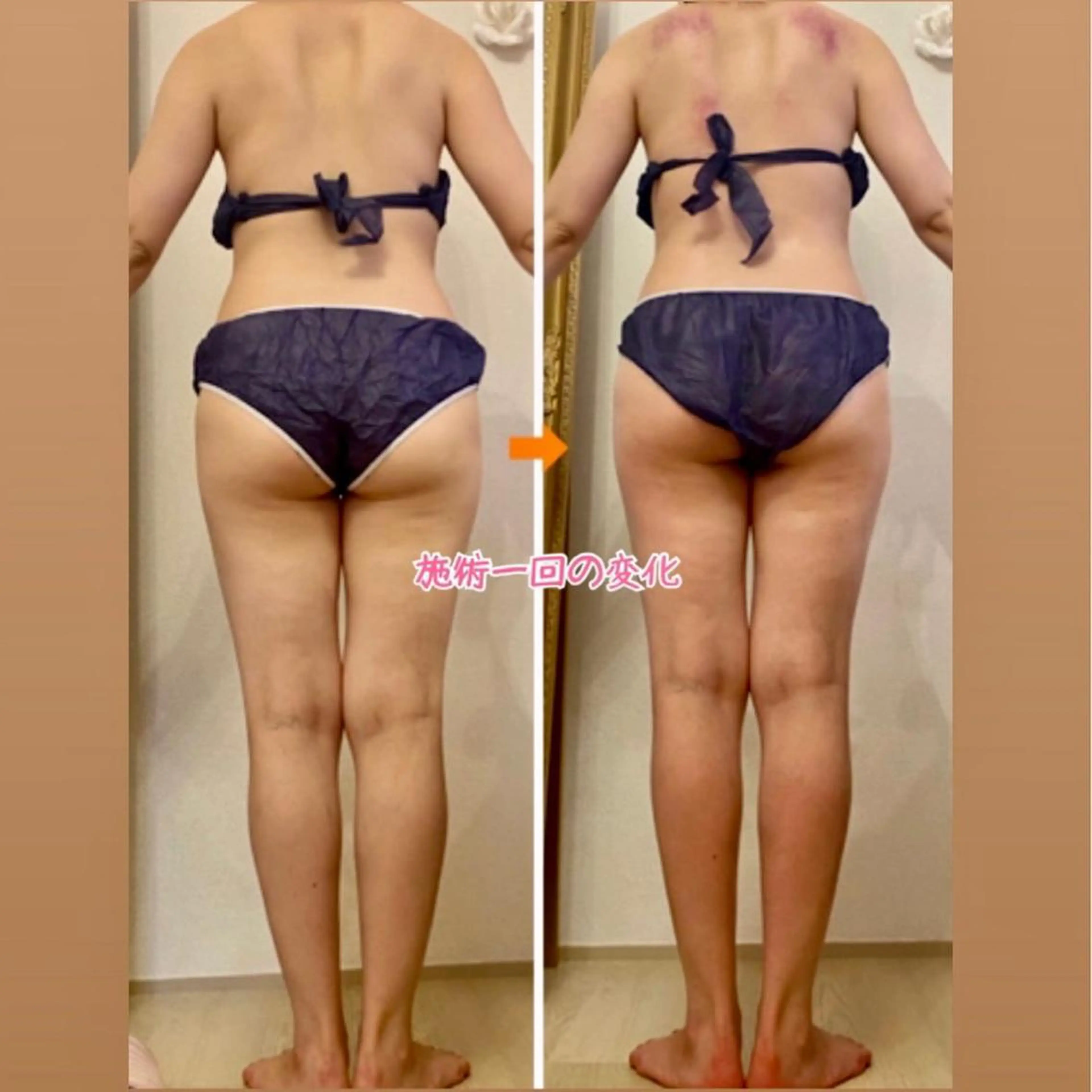 ショート カラー パーマ ヘアアレンジ メンズ キッズ ネイル マツエク・マツパ 赤色 ‍痩身＆ボディ 結果出し🌟丹野のエステ・リラクイメージ