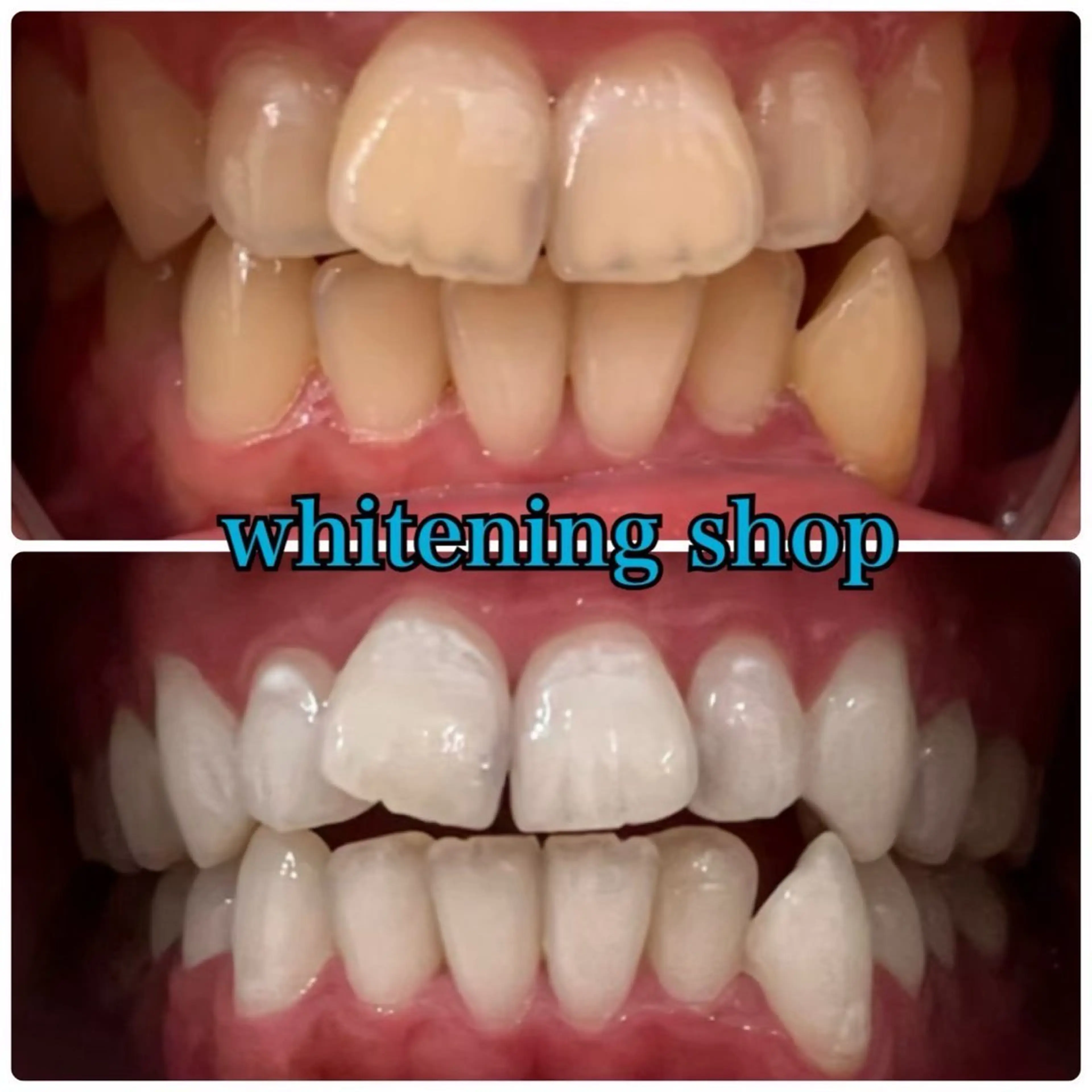 その他 ホワイトニング ショップ伊丹店のその他イメージ