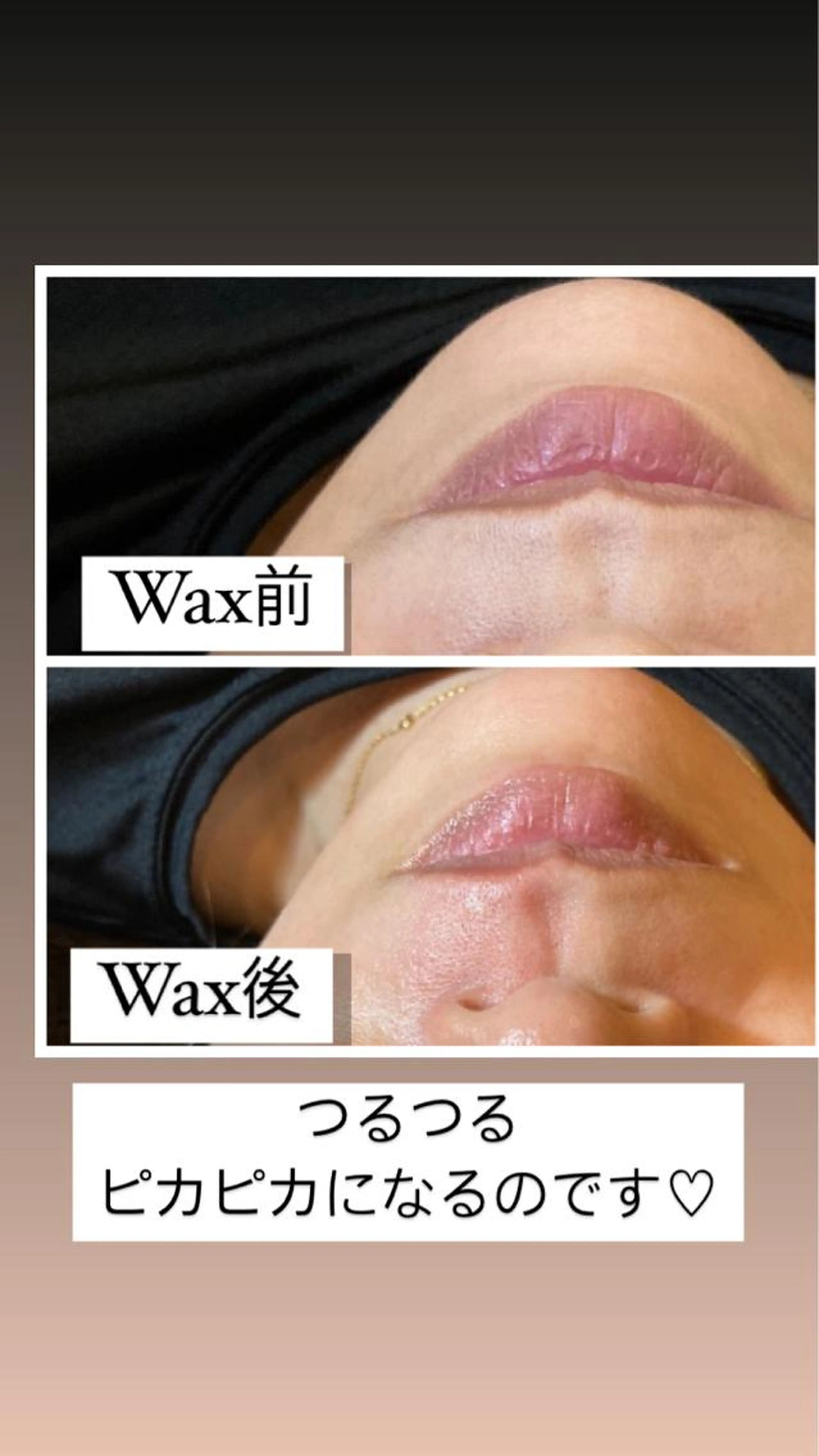 口周りWaxの写真