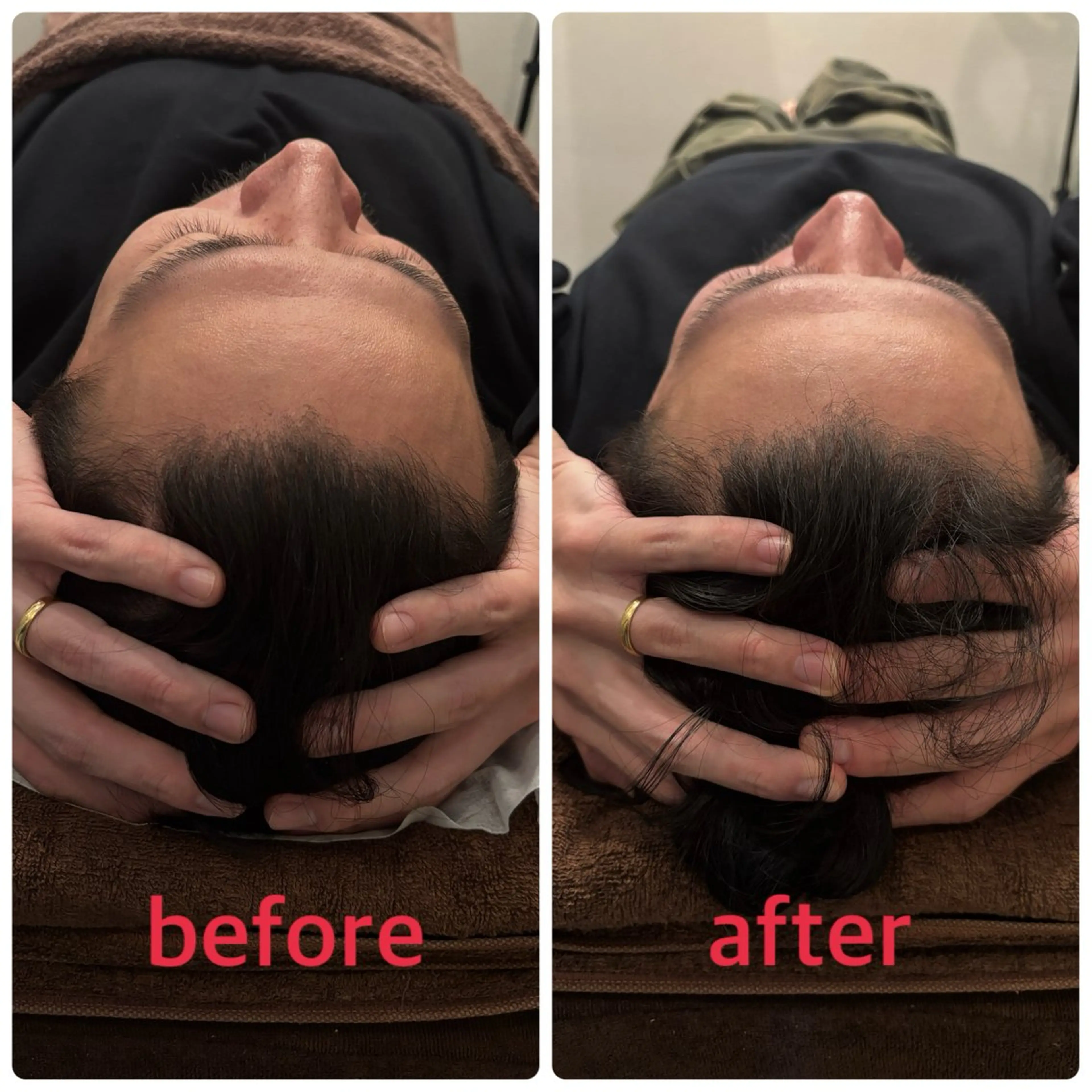 エステ リラク 小林整骨院本町 美容鍼roomのエステ・リラクイメージ