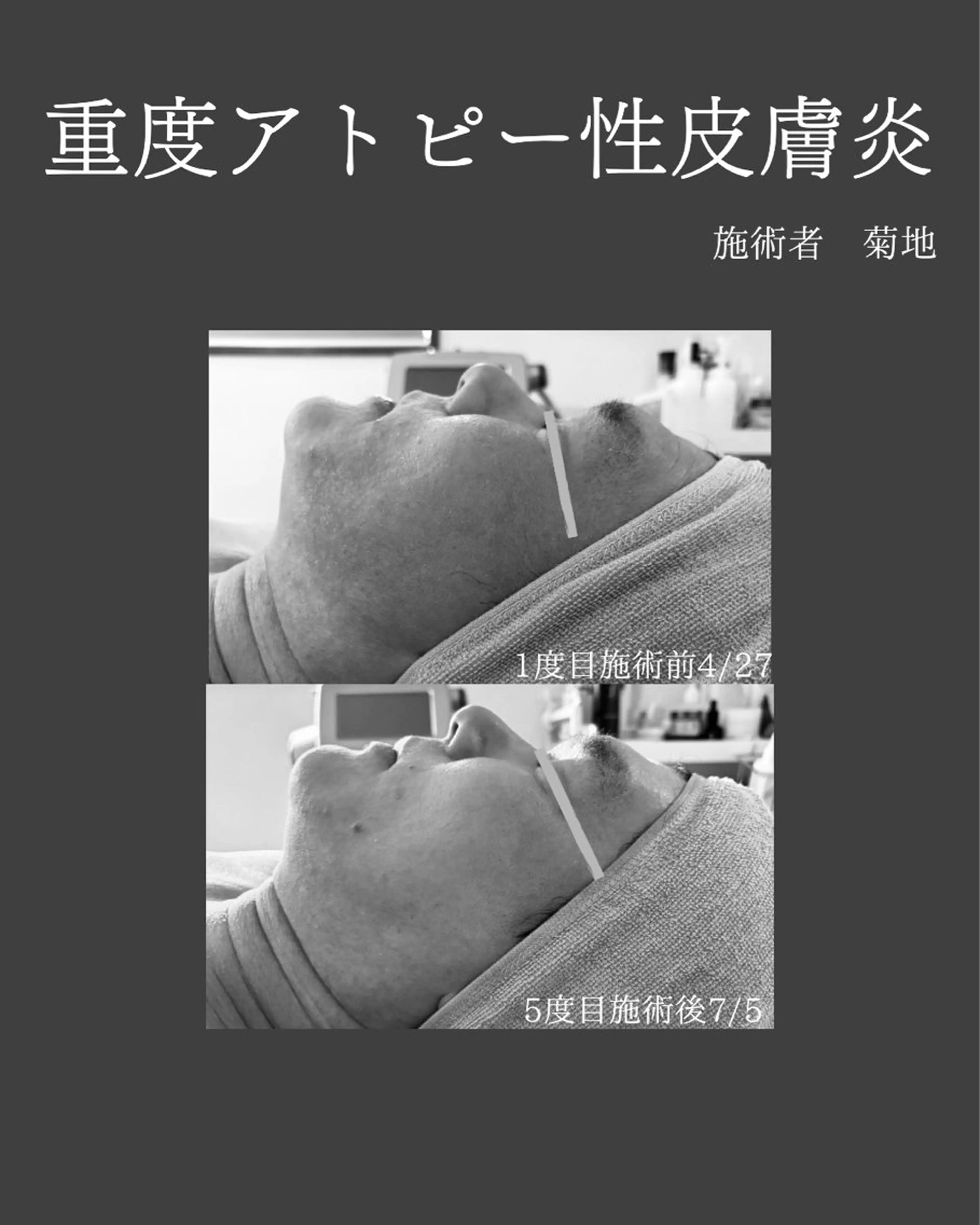 BLOSSOM 菊地のエステ・リラクイメージ