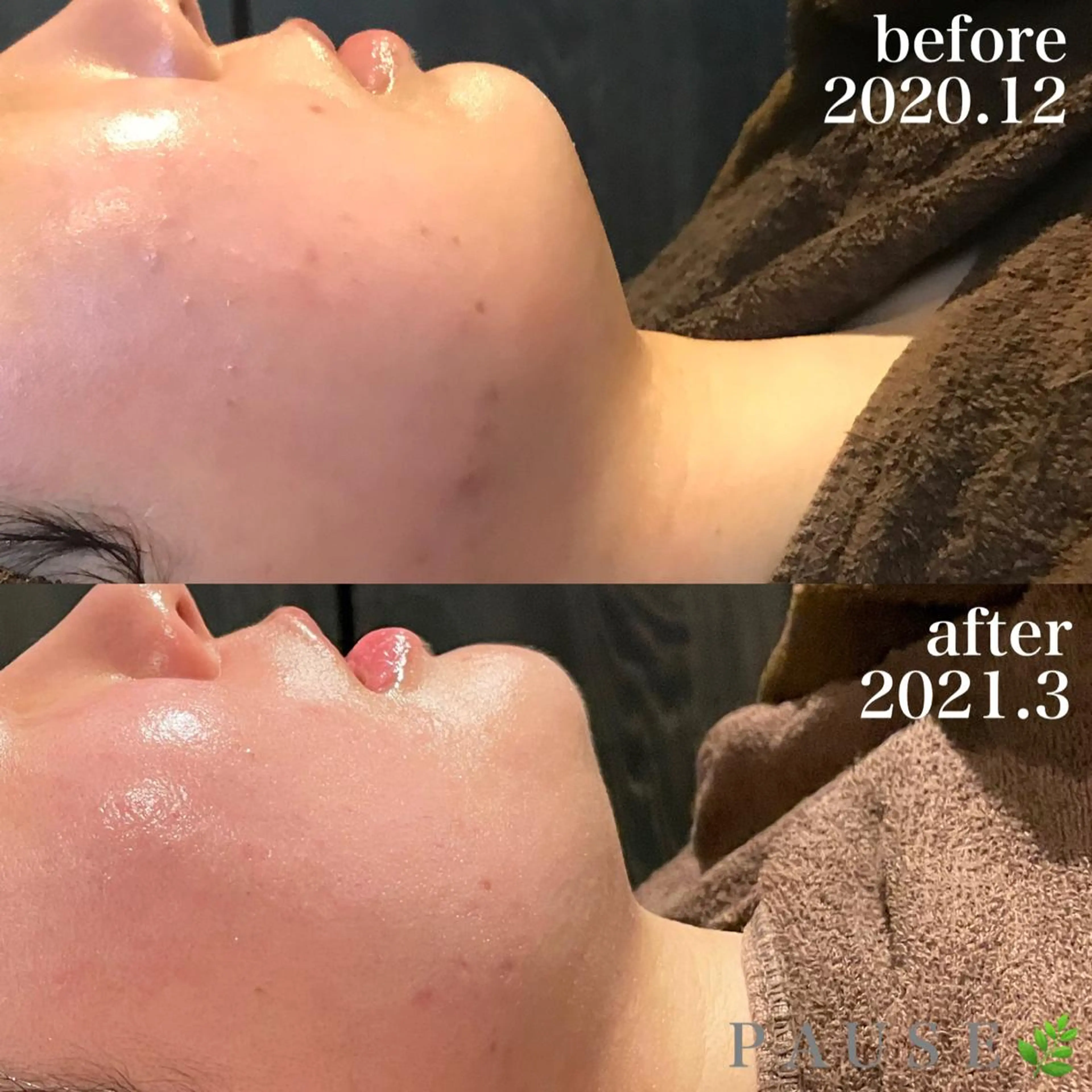 エステ 浜野 恵美のエステ・リラクイメージ