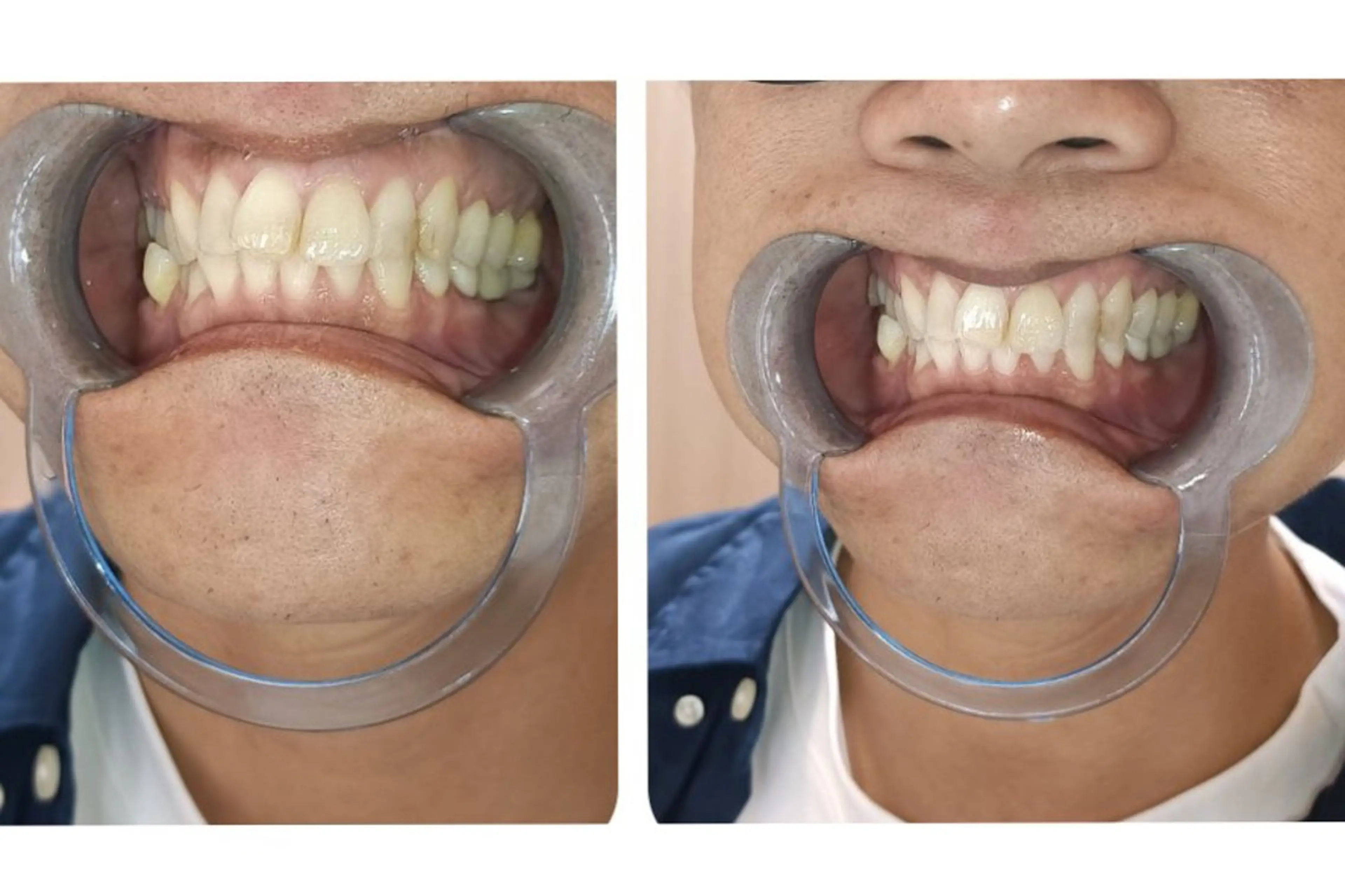 A-family  kaoriのエステ・リラクイメージ